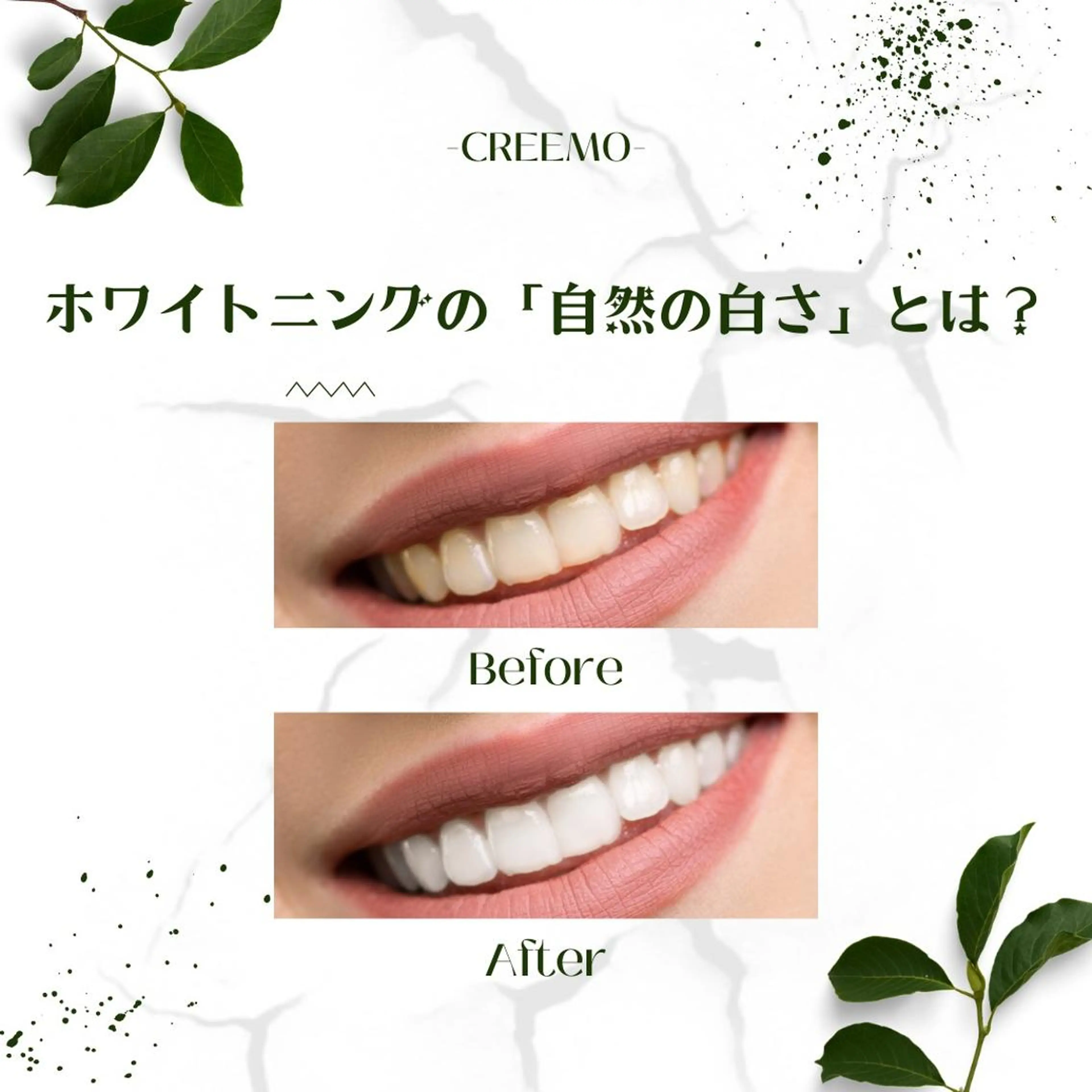 歯のホワイトニング CREEMO南浦和のその他イメージ