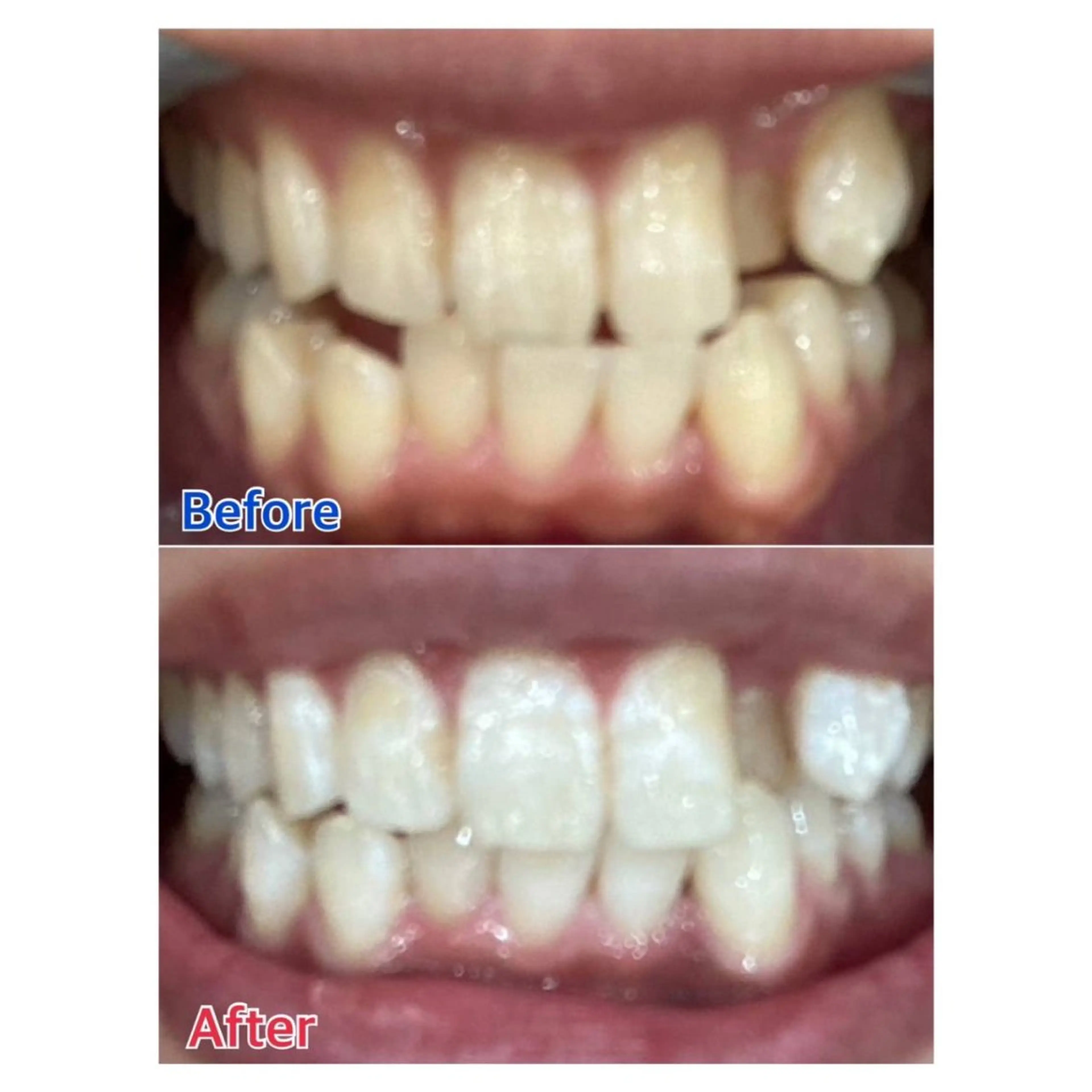 MBEAUTYSALON 千葉店・京成大久保所属・Melty 輝のその他イメージ