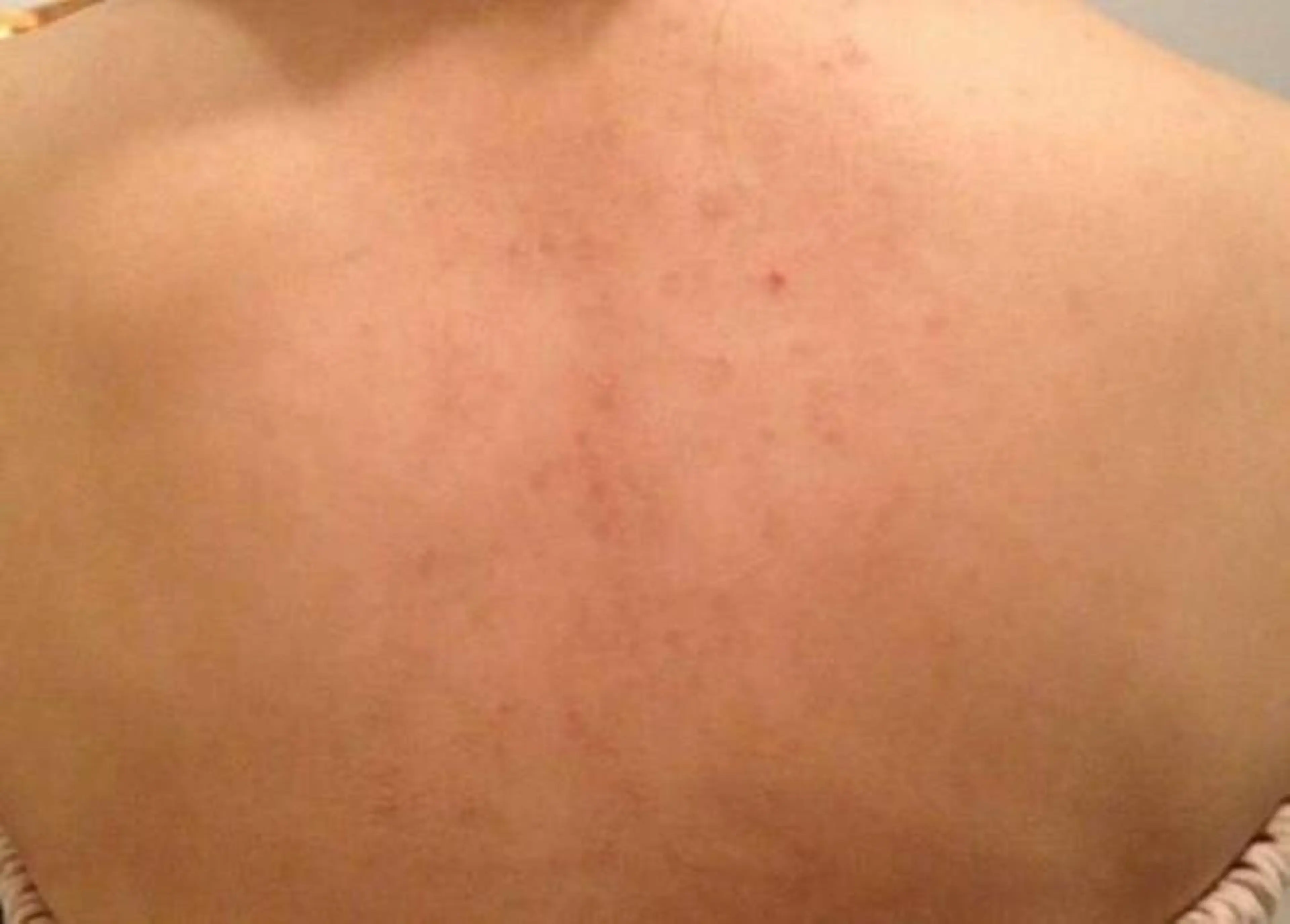 痩身リンパダイエット 隠れ家サロンチャームのエステ・リラクイメージ