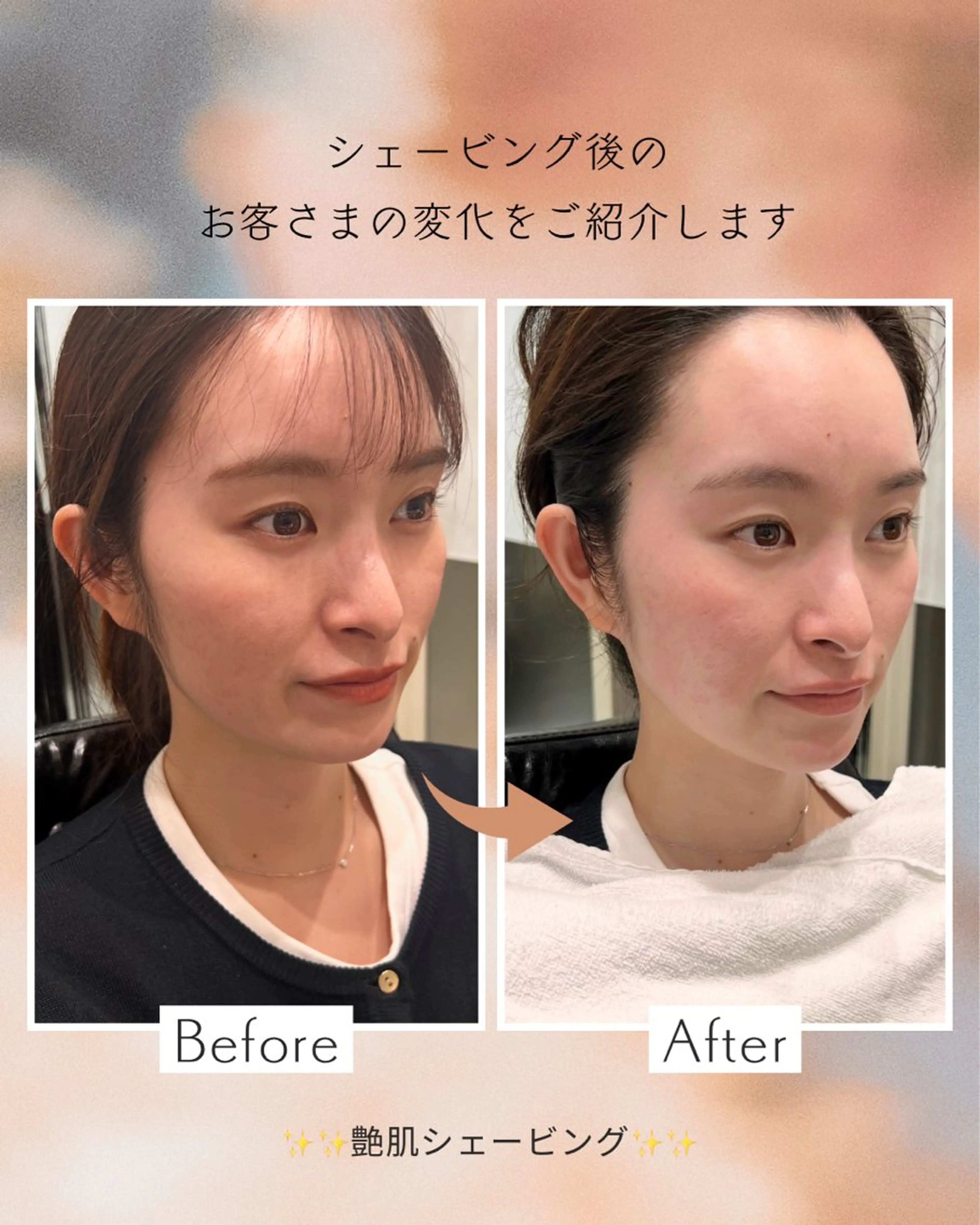 エステ リラク GOTODAY  SHAiRE SALON VITA店所属・艶肌シェービング✨ 小山/原宿のエステ・リラクイメージ