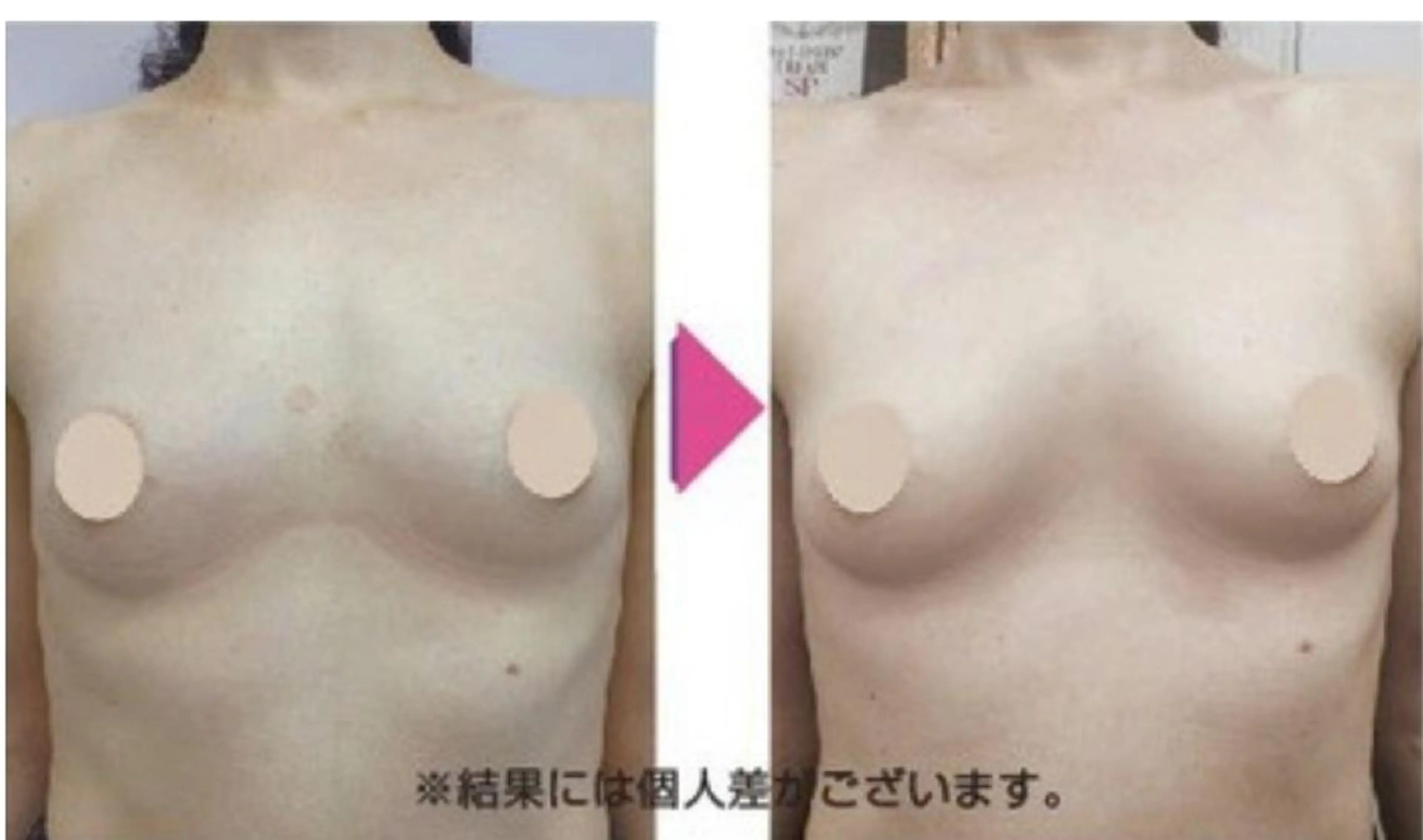 小顔と腸の専門店 ラクーラビューティのエステ・リラクイメージ