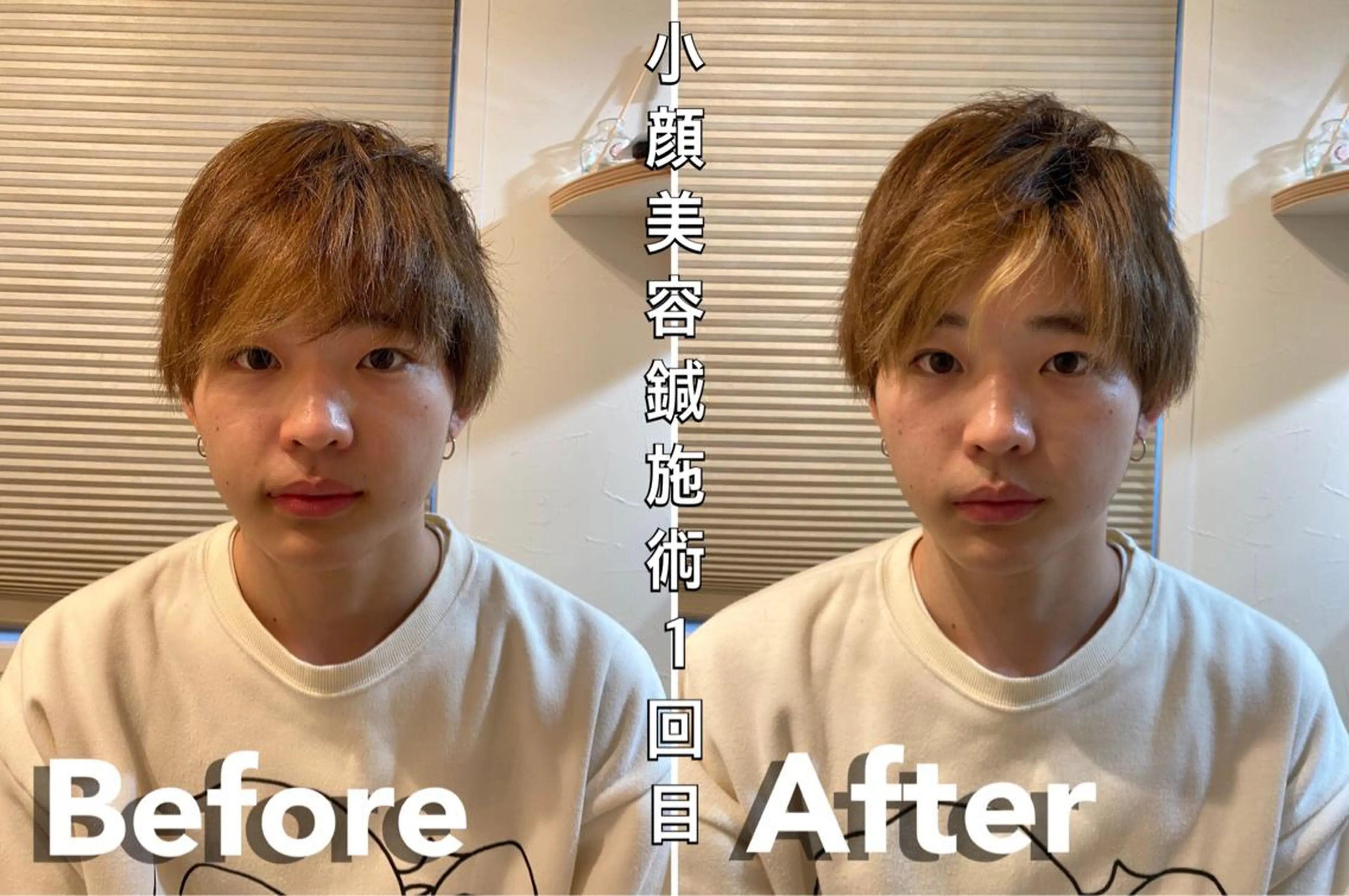 鍼灸整骨院Refine所属・鍼灸 Refineのその他イメージ
