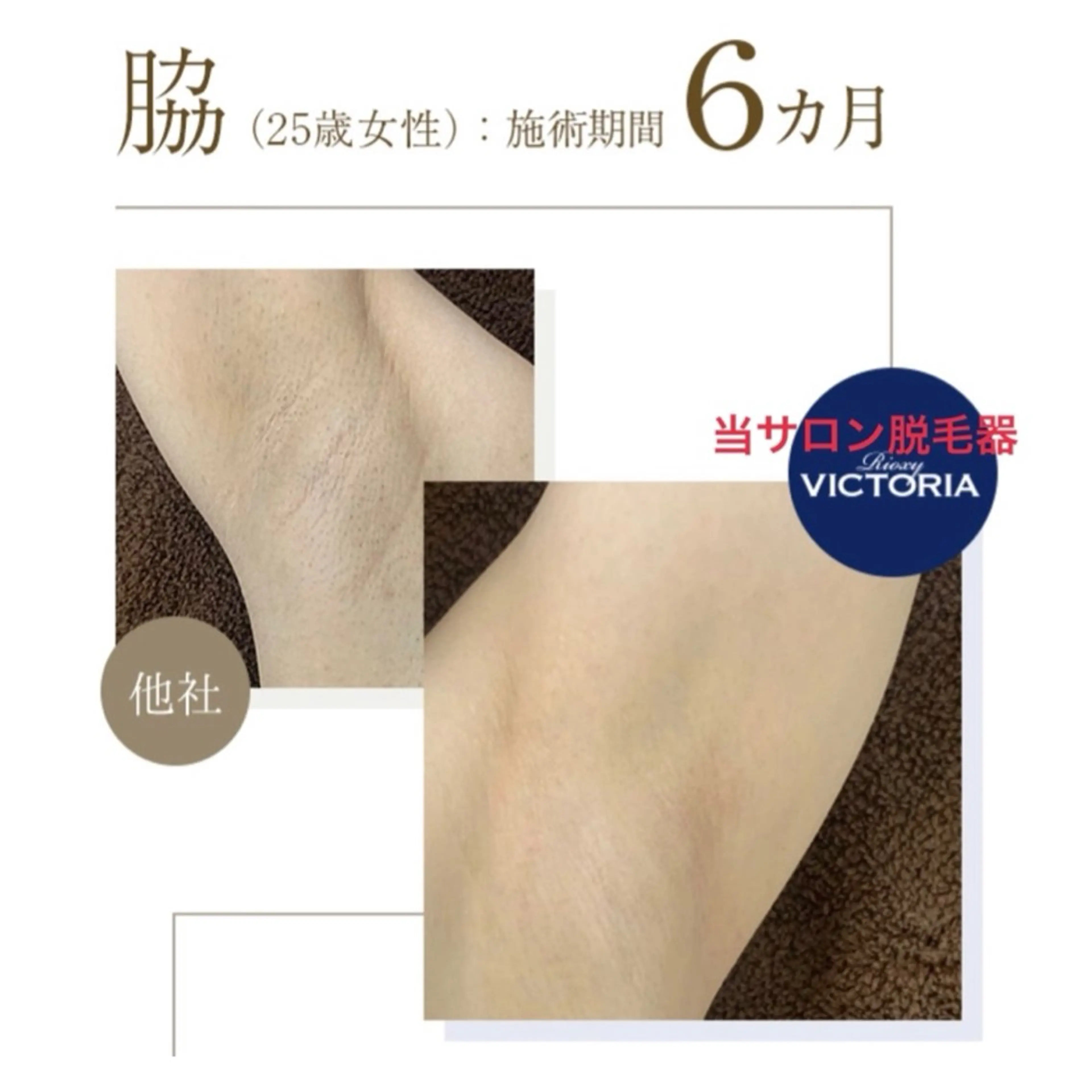 脱毛 M's Style NAIL BARのエステ・リラクイメージ