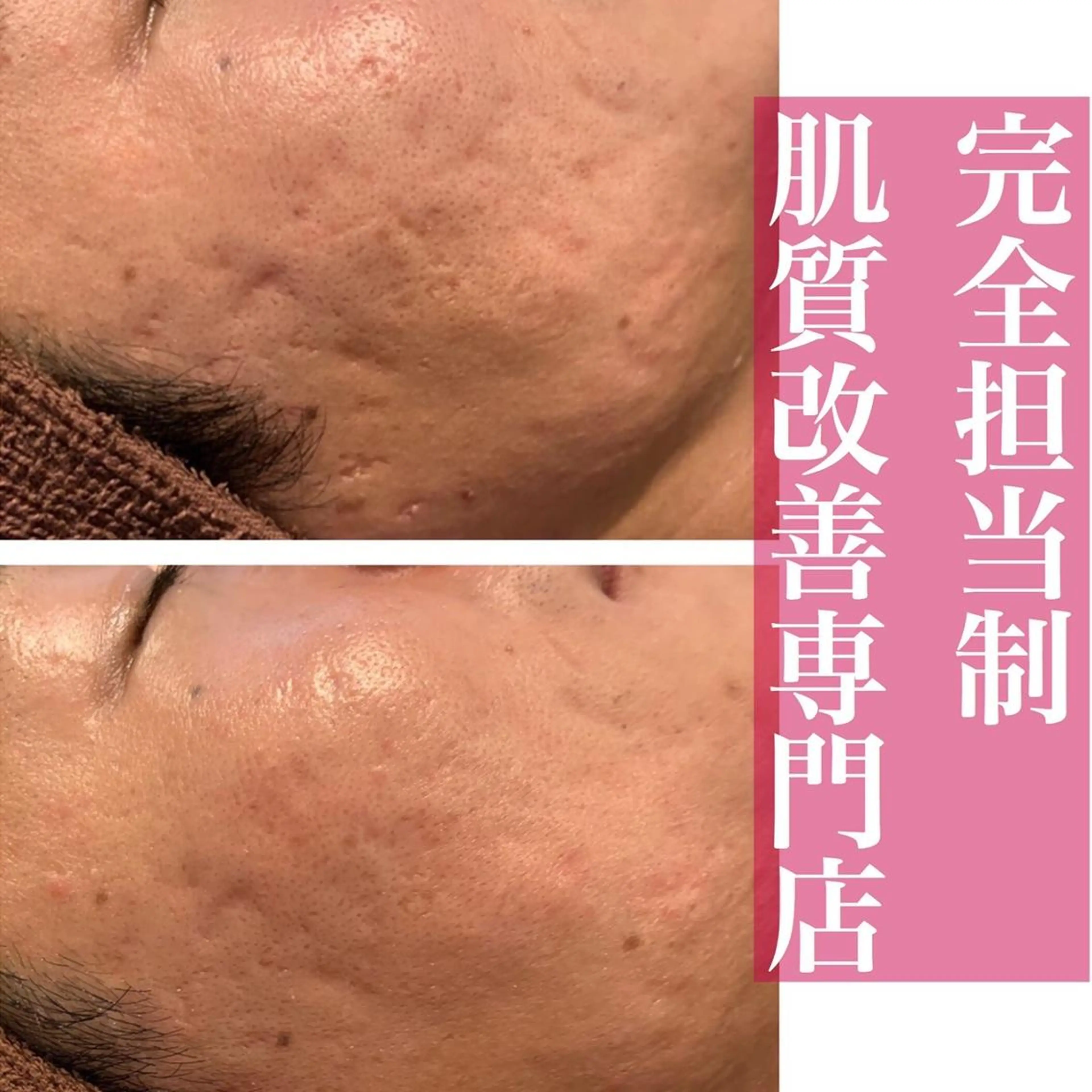 憧れのすっぴん韓流肌 🤎肌管理専門エステのエステ・リラクイメージ