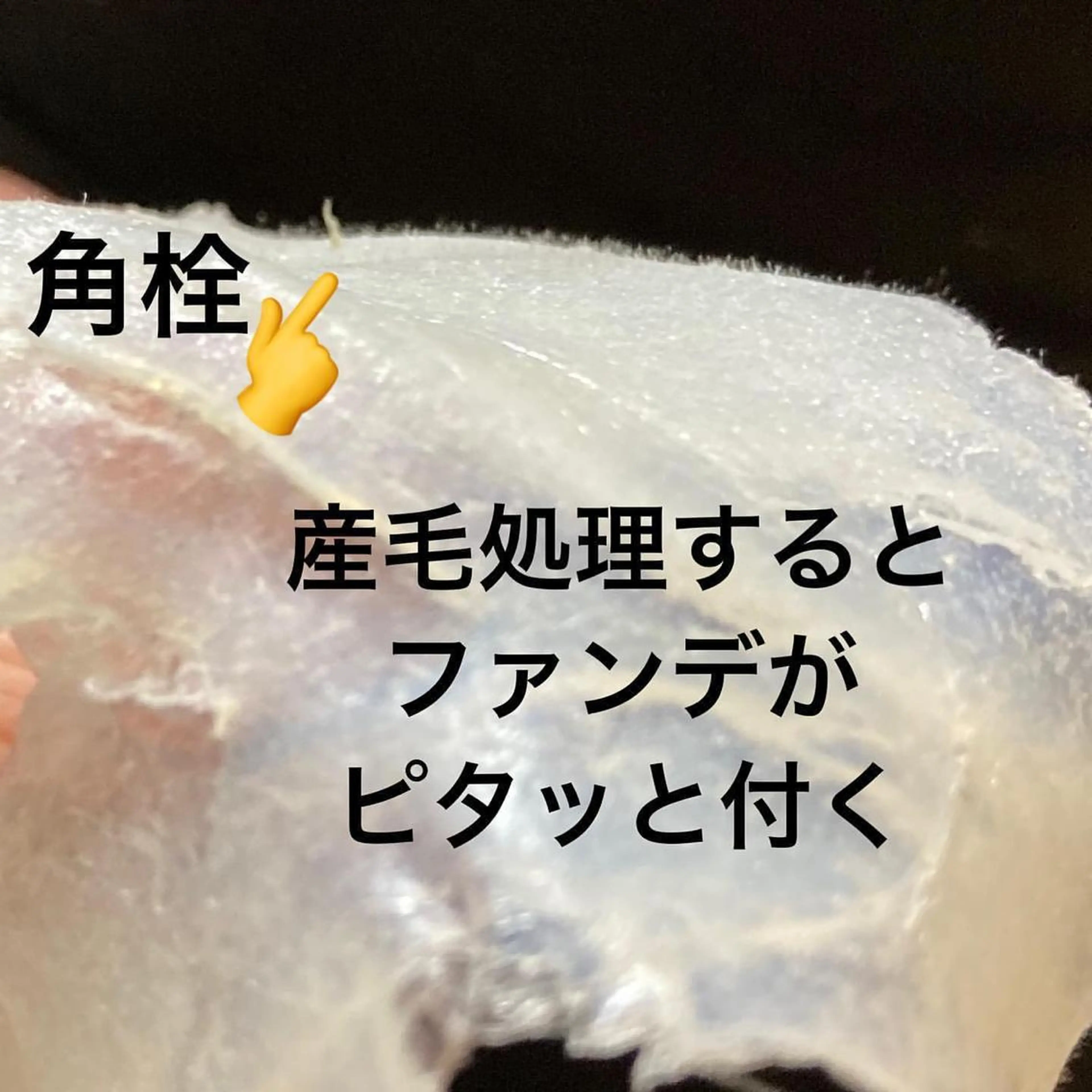 脱毛 産毛専門店 Bittoのエステ・リラクイメージ