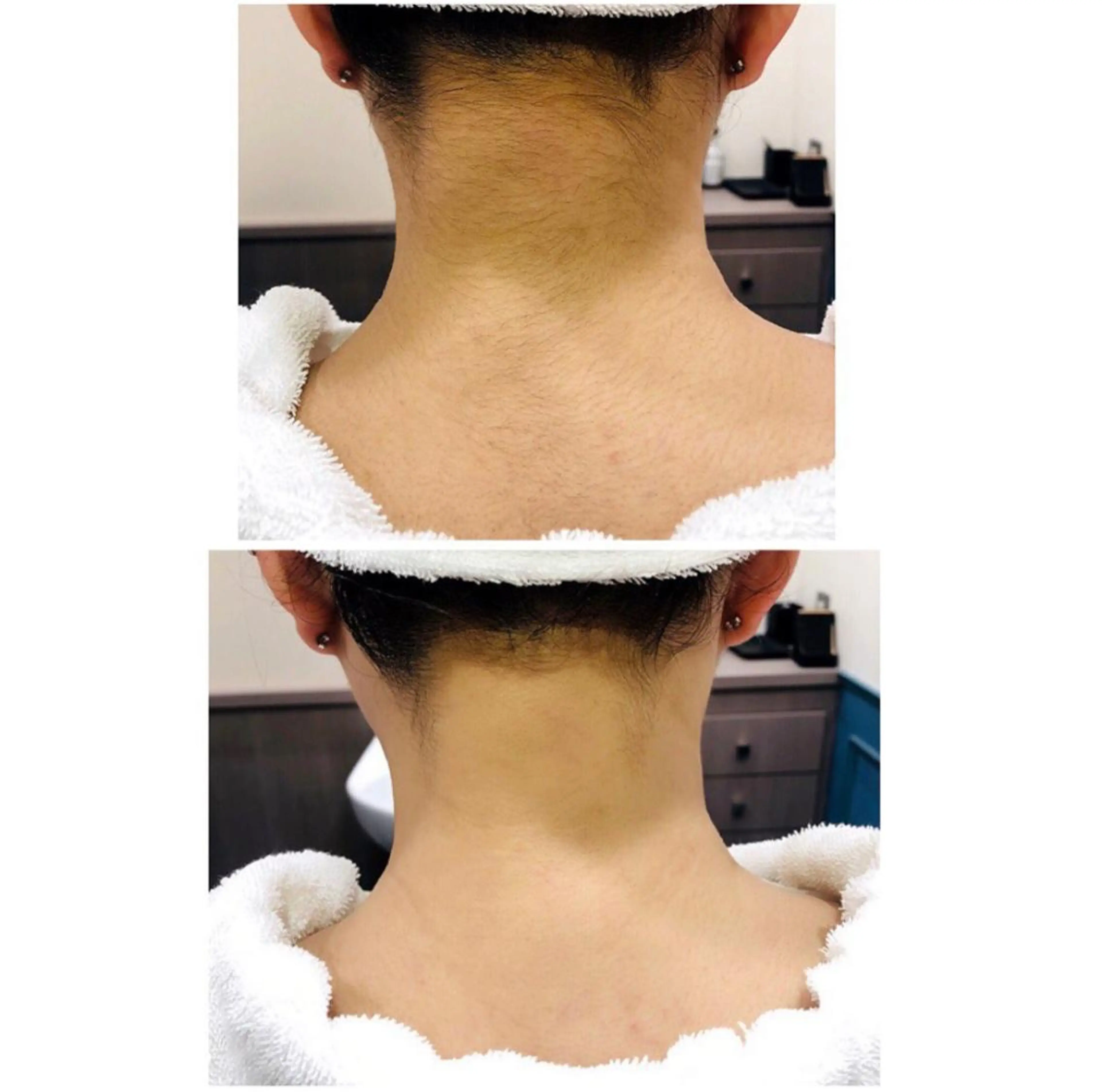脱毛 銀座マツナガ新宿野村ビル店所属・女性理容師 佐藤優菜のヘアスタイル