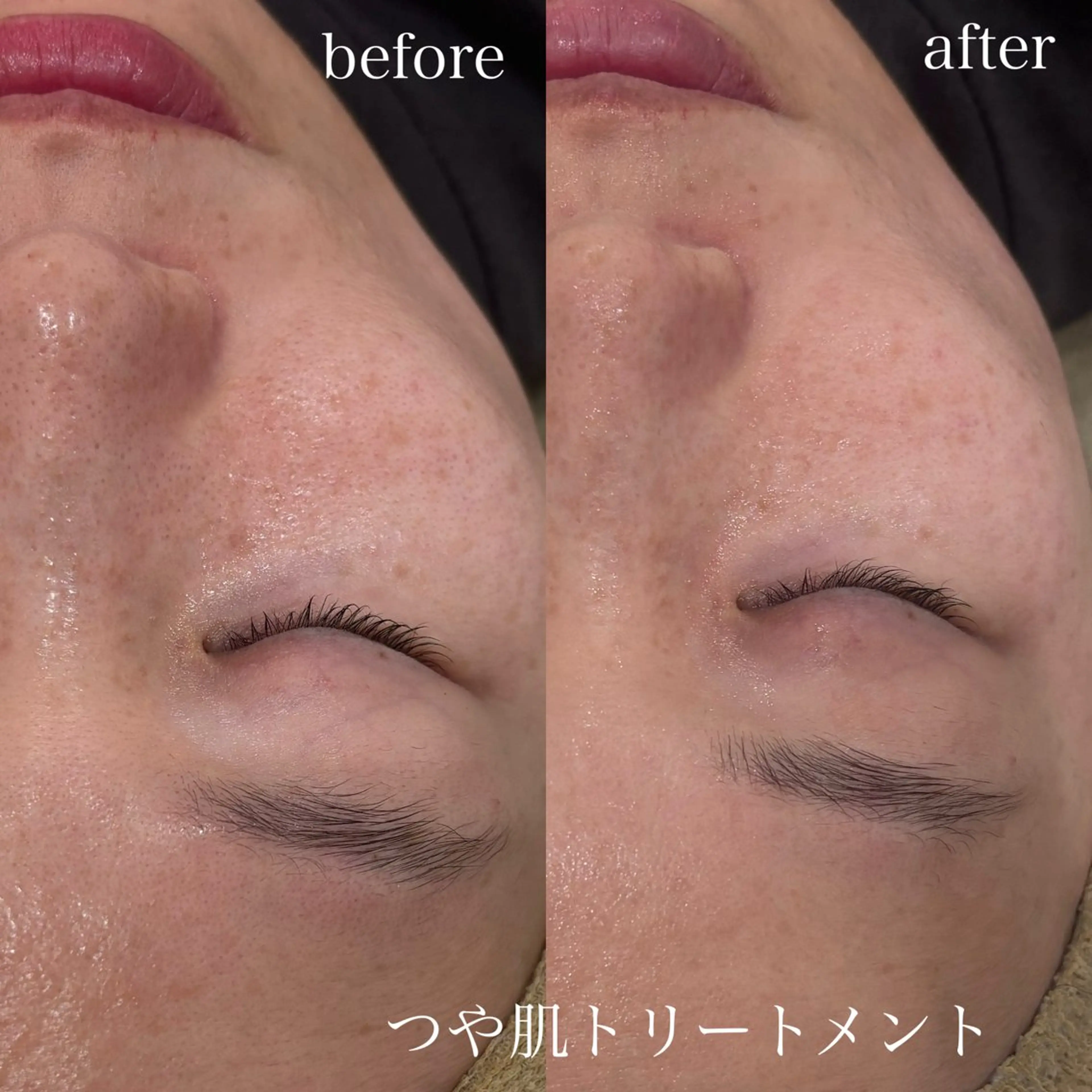 エステ Re.Grace所属・Re.Grace片野 由茉のエステ・リラクイメージ