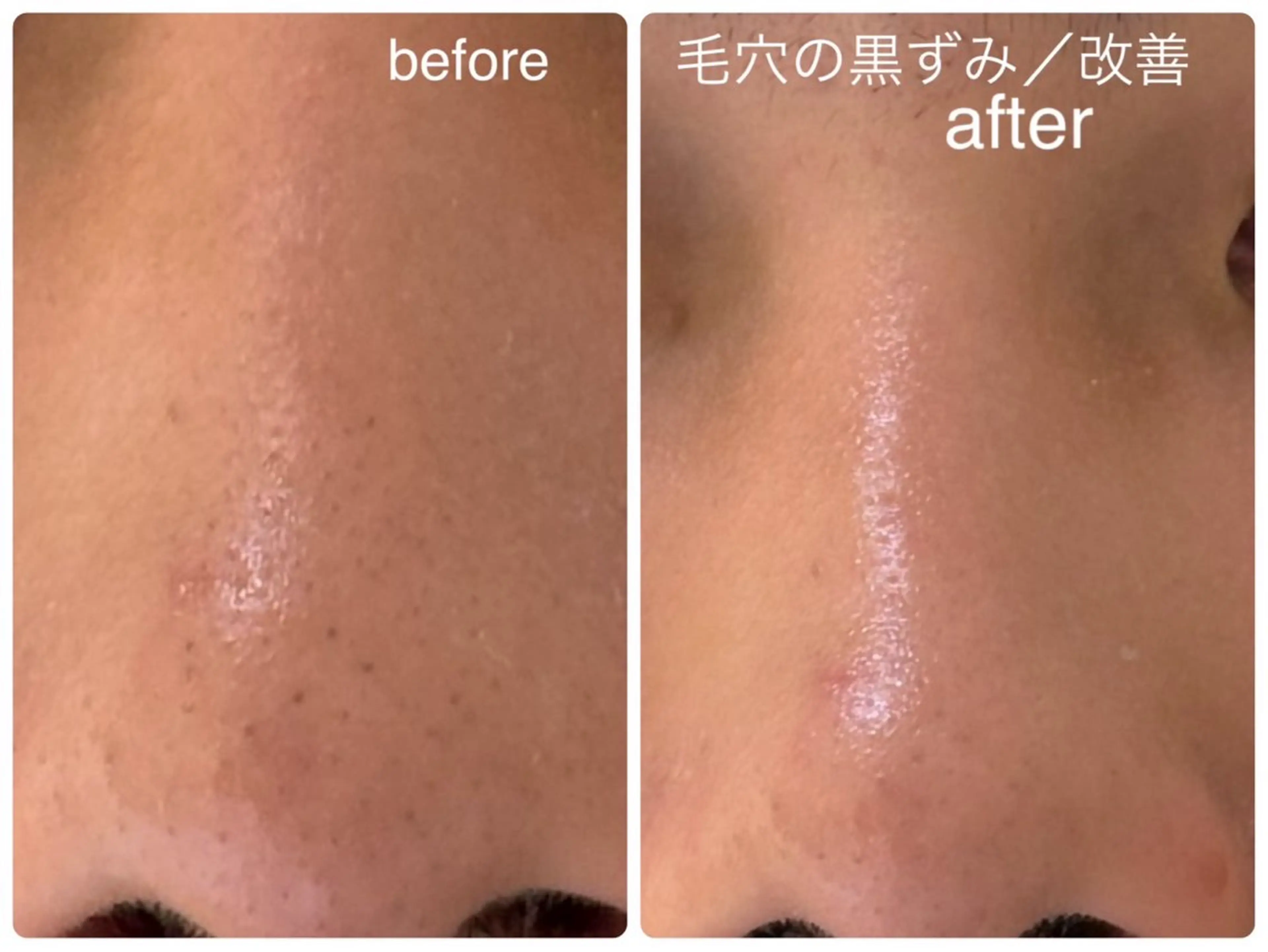 メンズ エステ ヤスダ ユウコのエステ・リラクイメージ