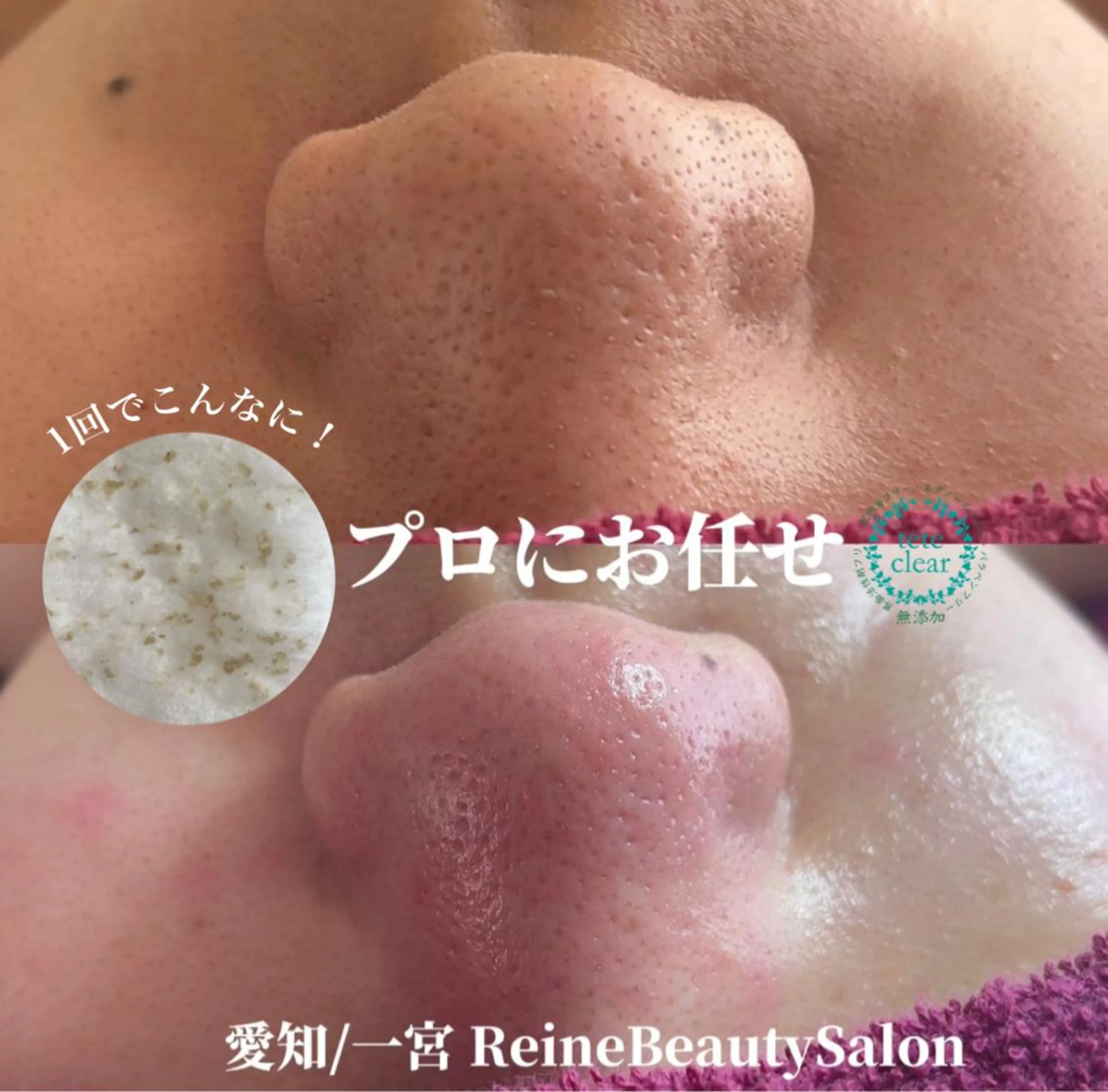 エステ Reine BeautySalon所属・毛穴/シミ肝斑/脱毛 横山梨里のエステ・リラクイメージ