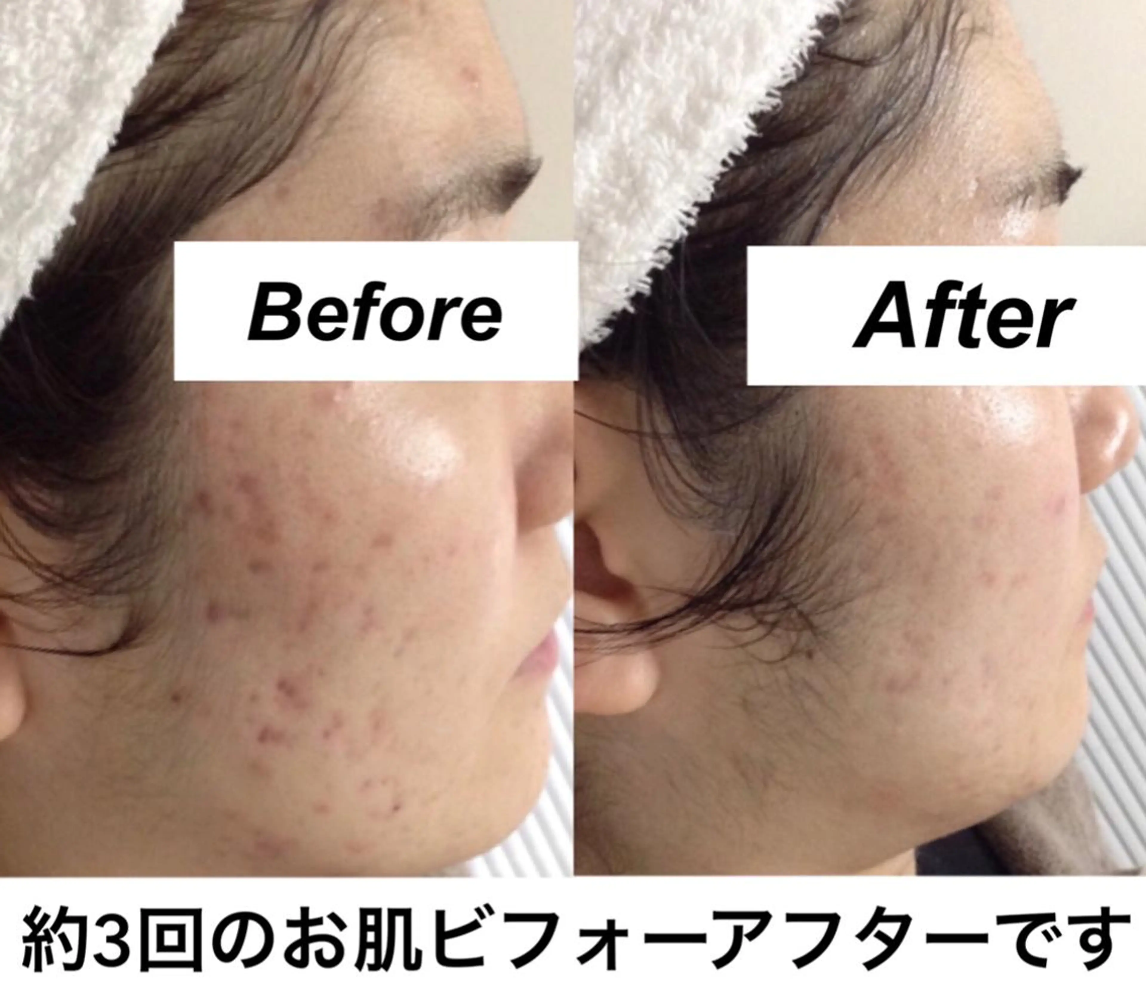 エステ リラク 都度払い肌質改善 &脱毛Blancheのエステ・リラクイメージ