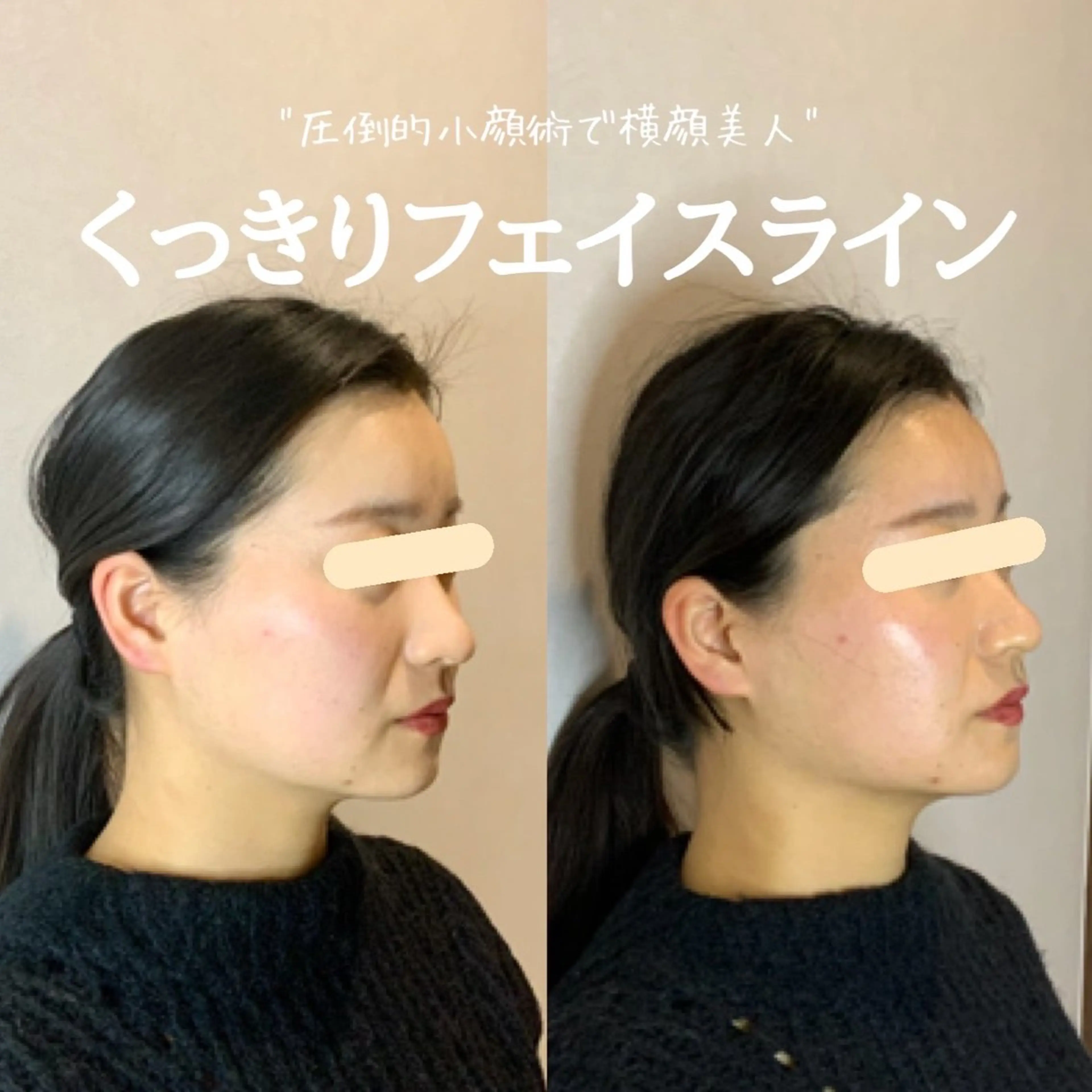 エステ 最速小顔・肌質管理 ❣️エスポワールのエステ・リラクイメージ
