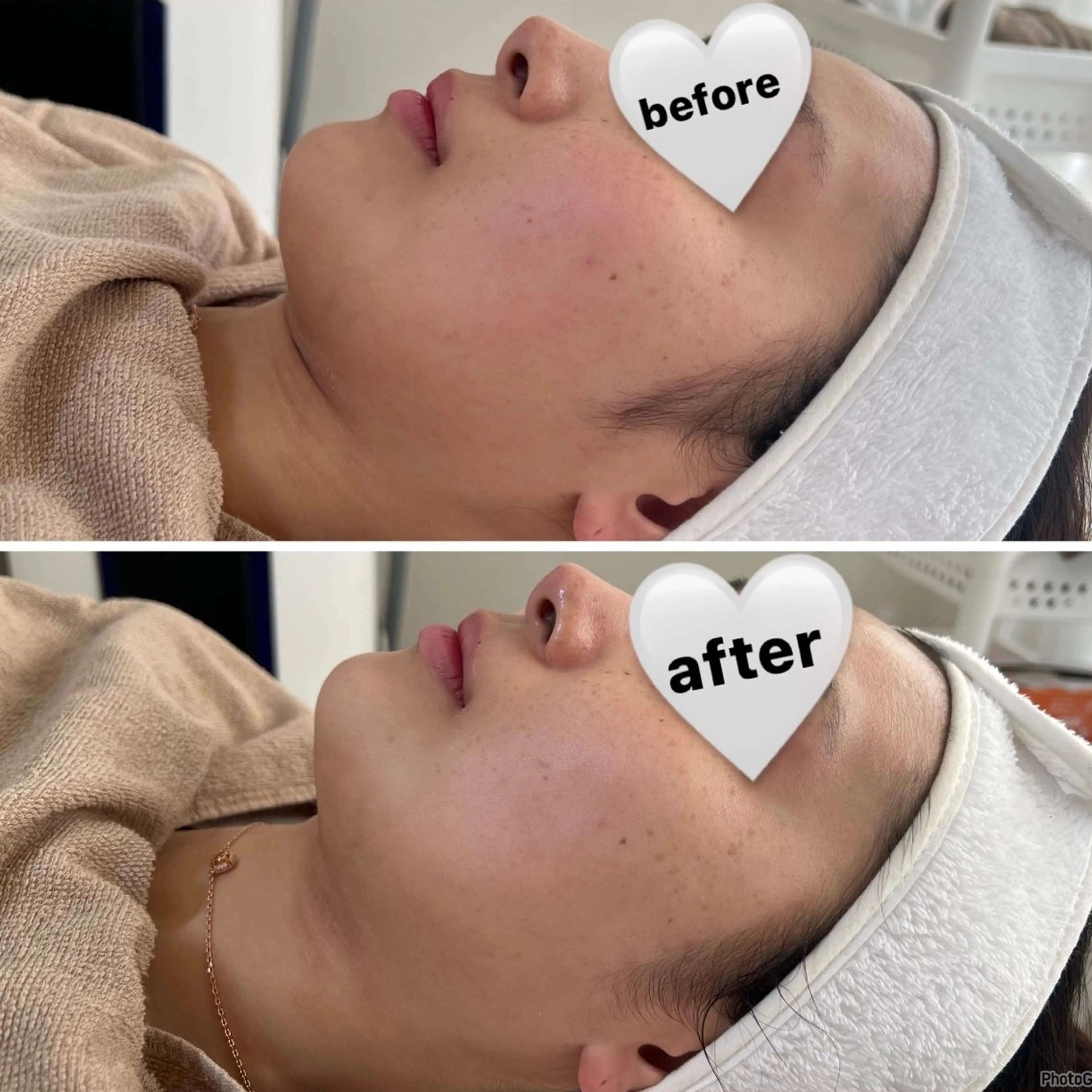 エステ 脱毛＆Beauty salon IILA所属・肌管理/HBL専門店 Sakuraの眉毛・アイブロウイメージ
