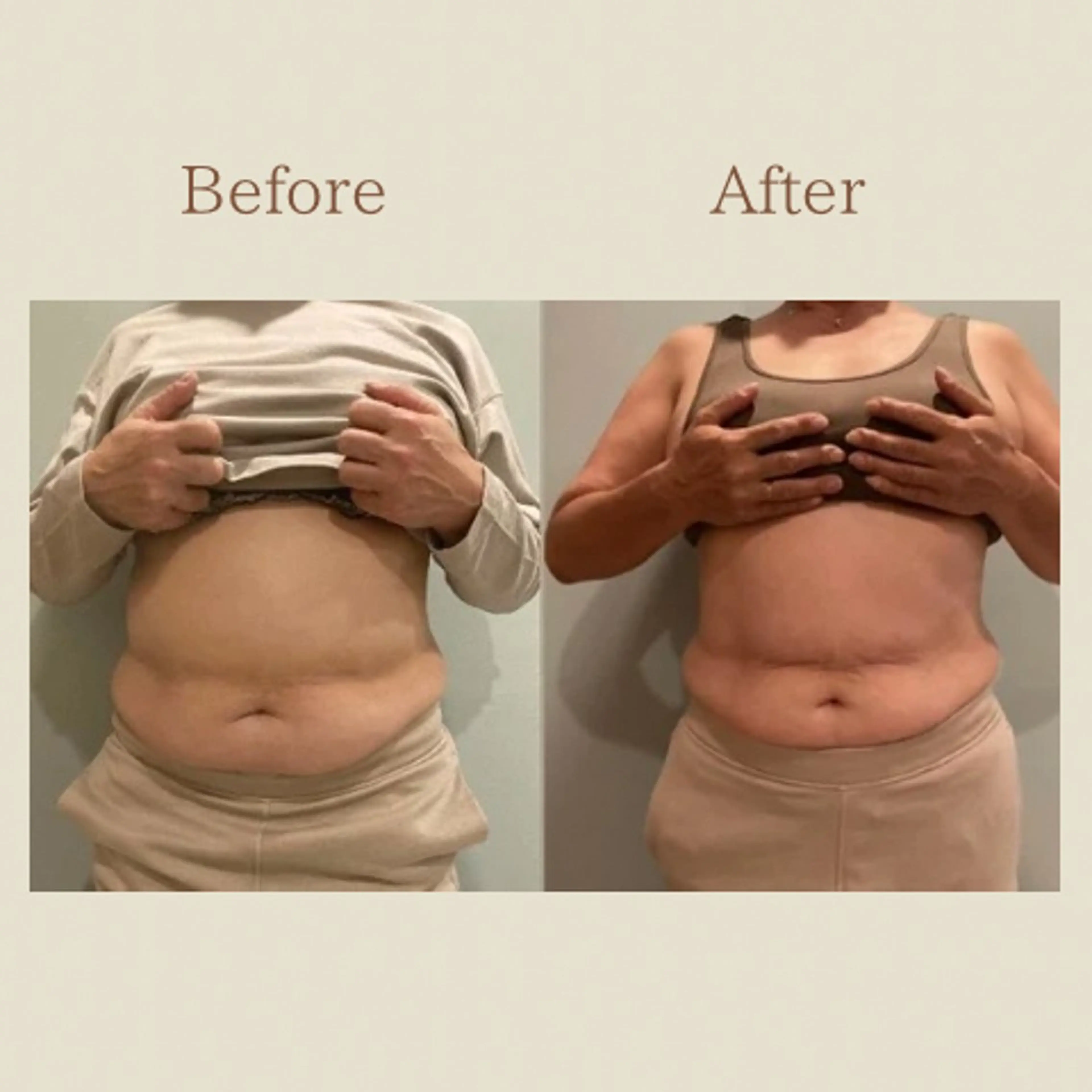 お腹痩せエステ Flat BELLY 恵比寿所属・【腸もみ/脂肪冷却】 お腹エステ/恵比寿のエステ・リラクイメージ