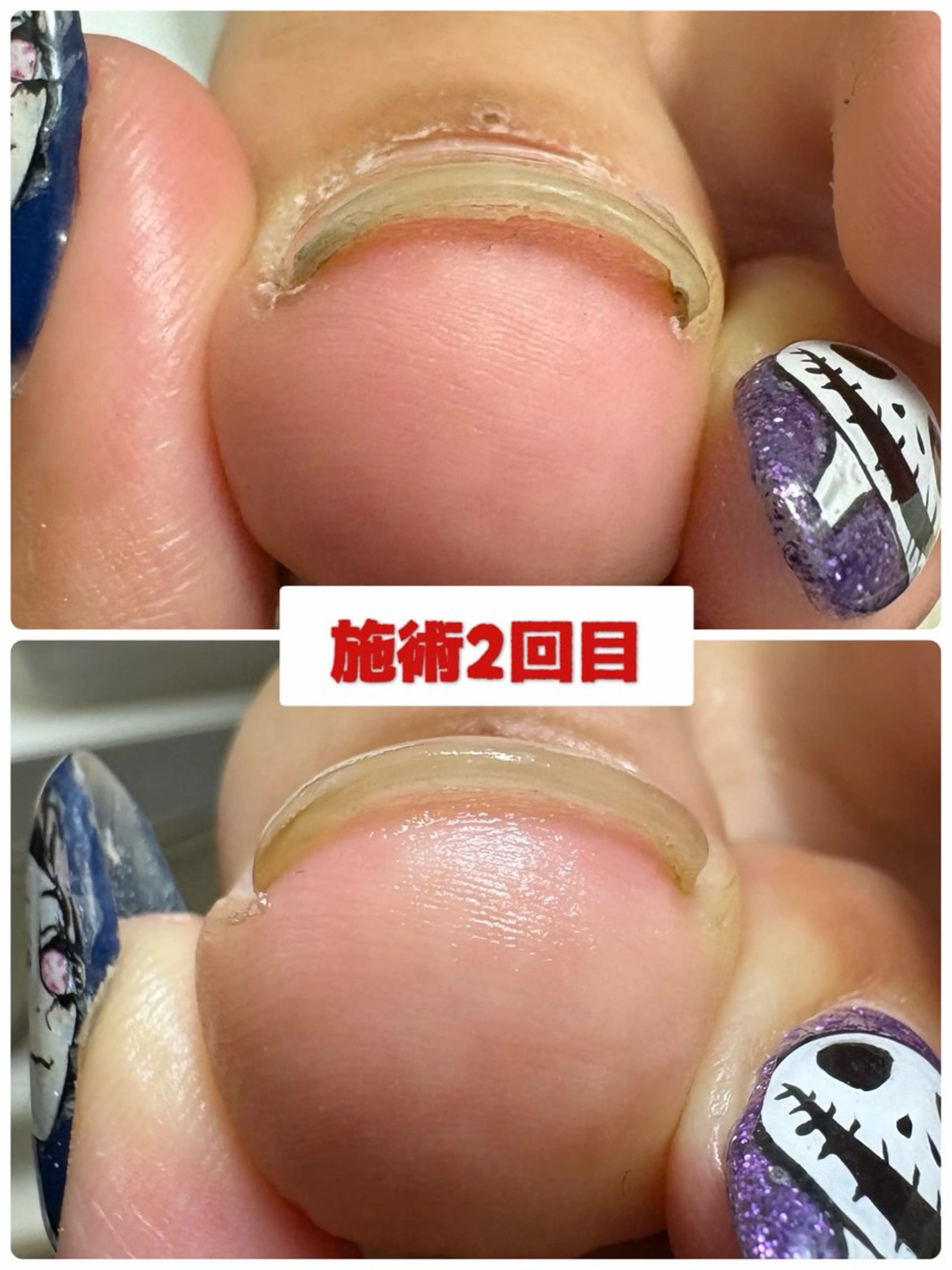 ネイル フットネイル Eri nail所属・nail salon -TOIRO-のネイルデザイン