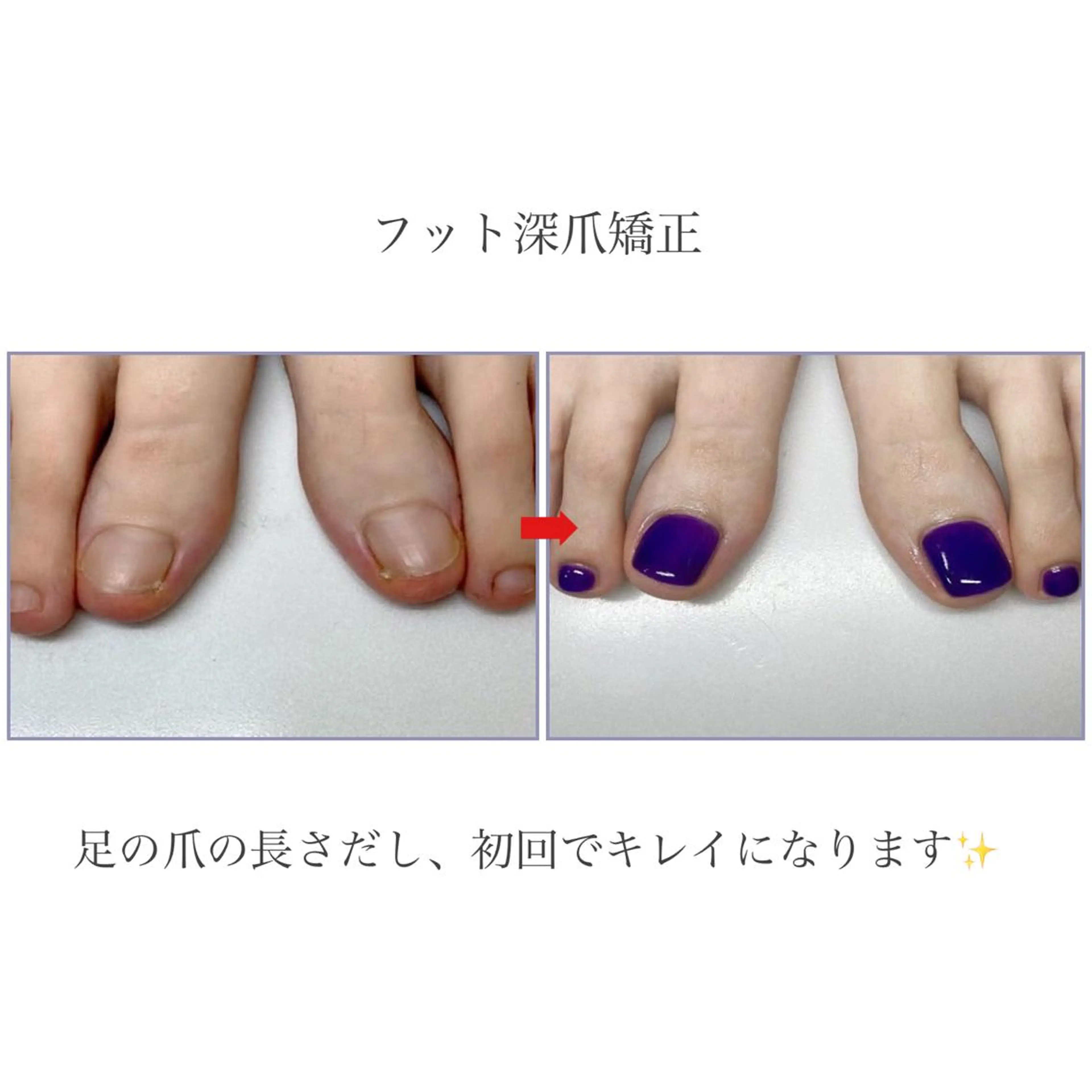 ネイル フットネイル ネイルサロンアリューム所属・ネイルサロン アリュームのネイルデザイン