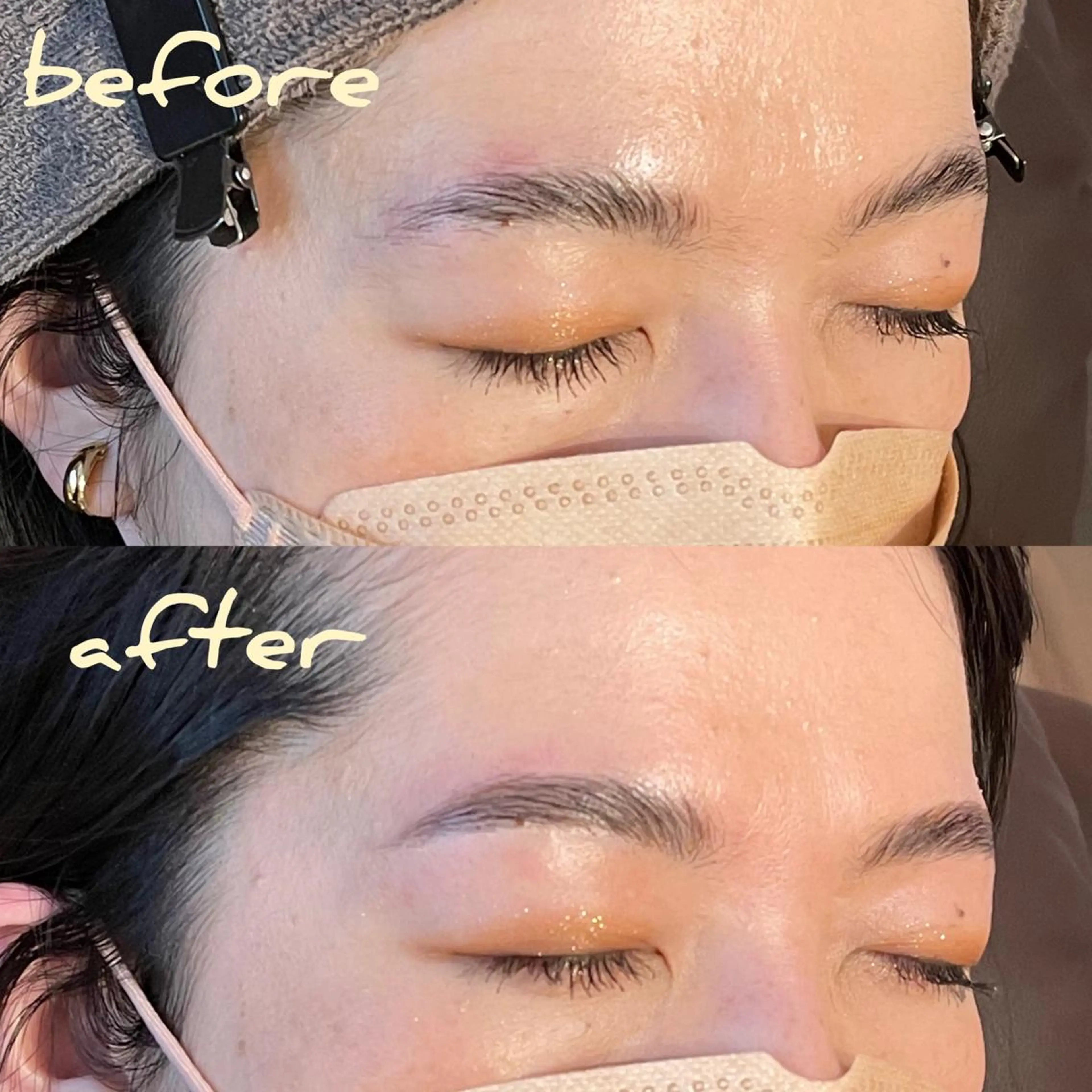 メンズ キッズ アイブロウ メンズパーマ ハリウッドブロウリフト 眉毛ワックス脱毛 ワックス脱毛 眉カット その他(アイブロウ) meetite mikiの眉毛・アイブロウイメージ