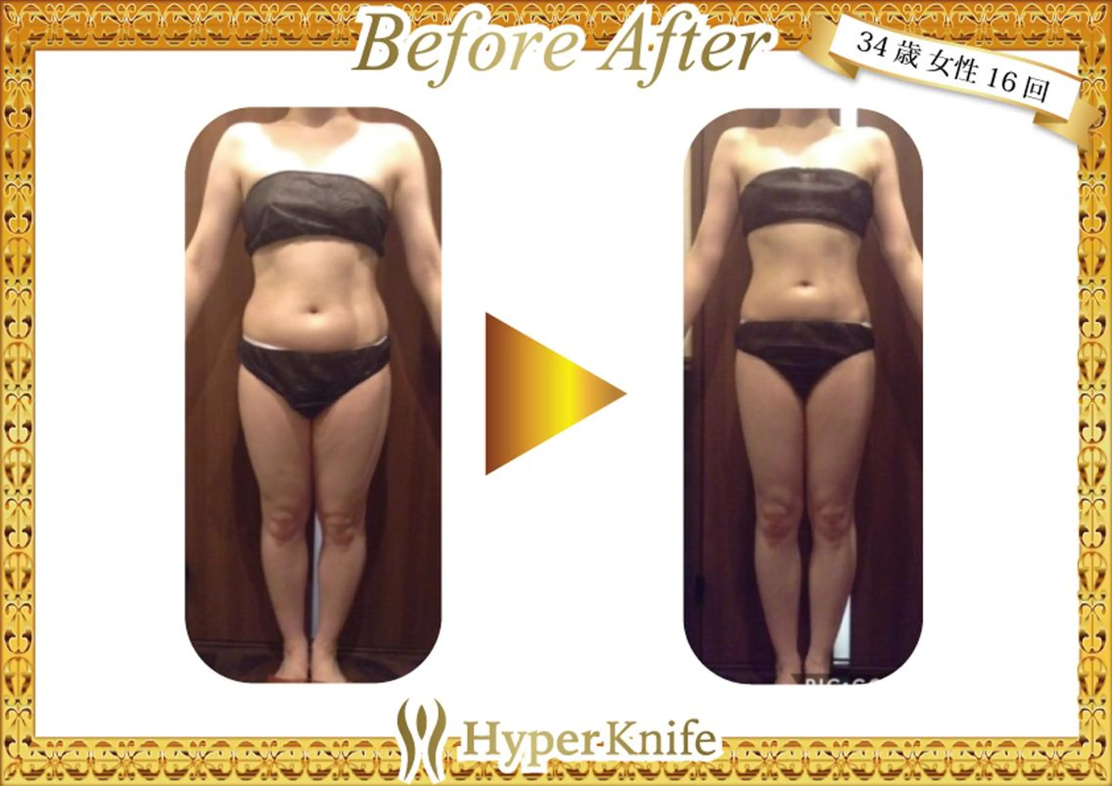 所沢痩身小顔コルギ AromaQueenのエステ・リラクイメージ