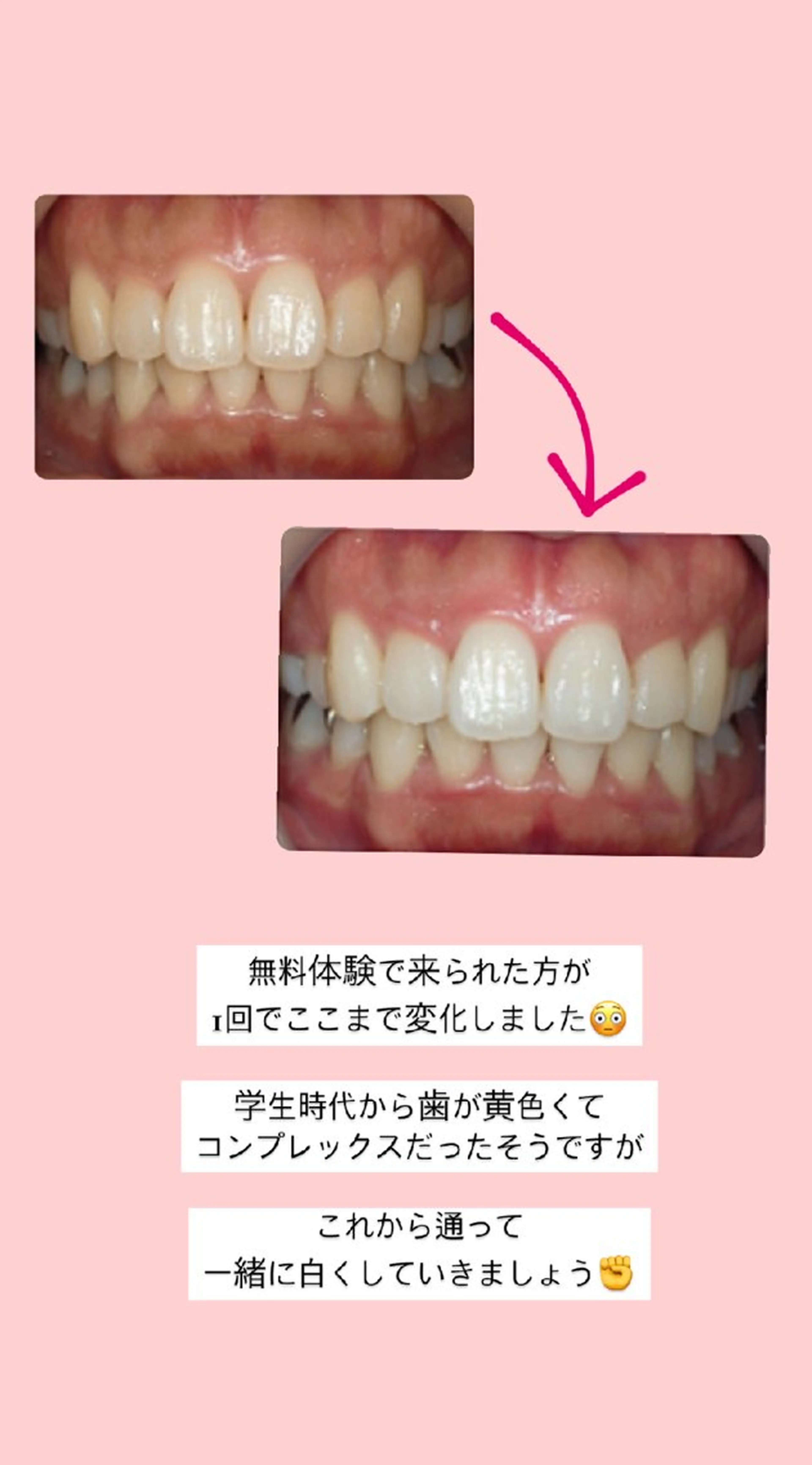 ecxia  white 　広島袋町店所属・セルフホワイトニング エクシア広島袋町店のその他イメージ