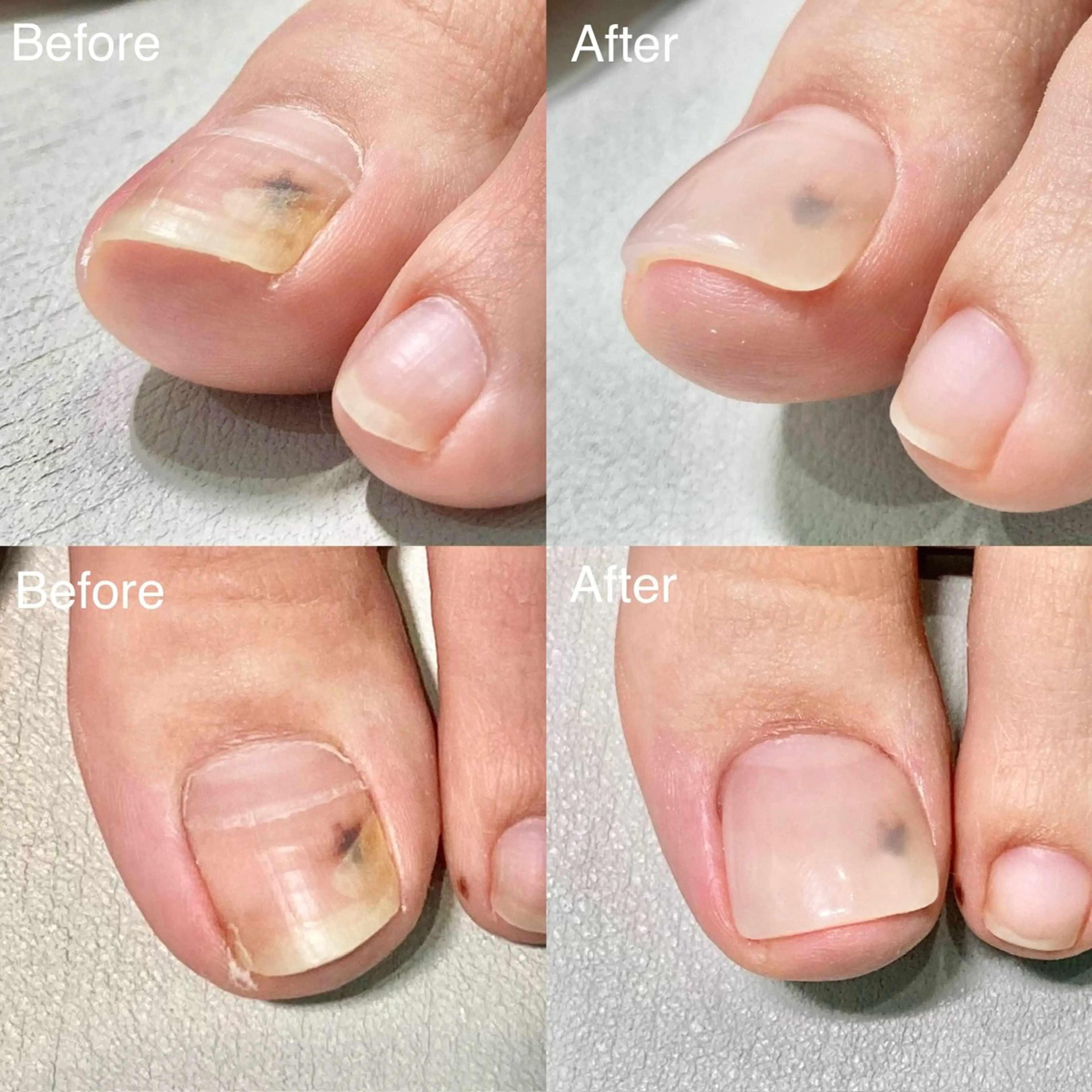 ネイル 小野 絵美のネイルデザイン