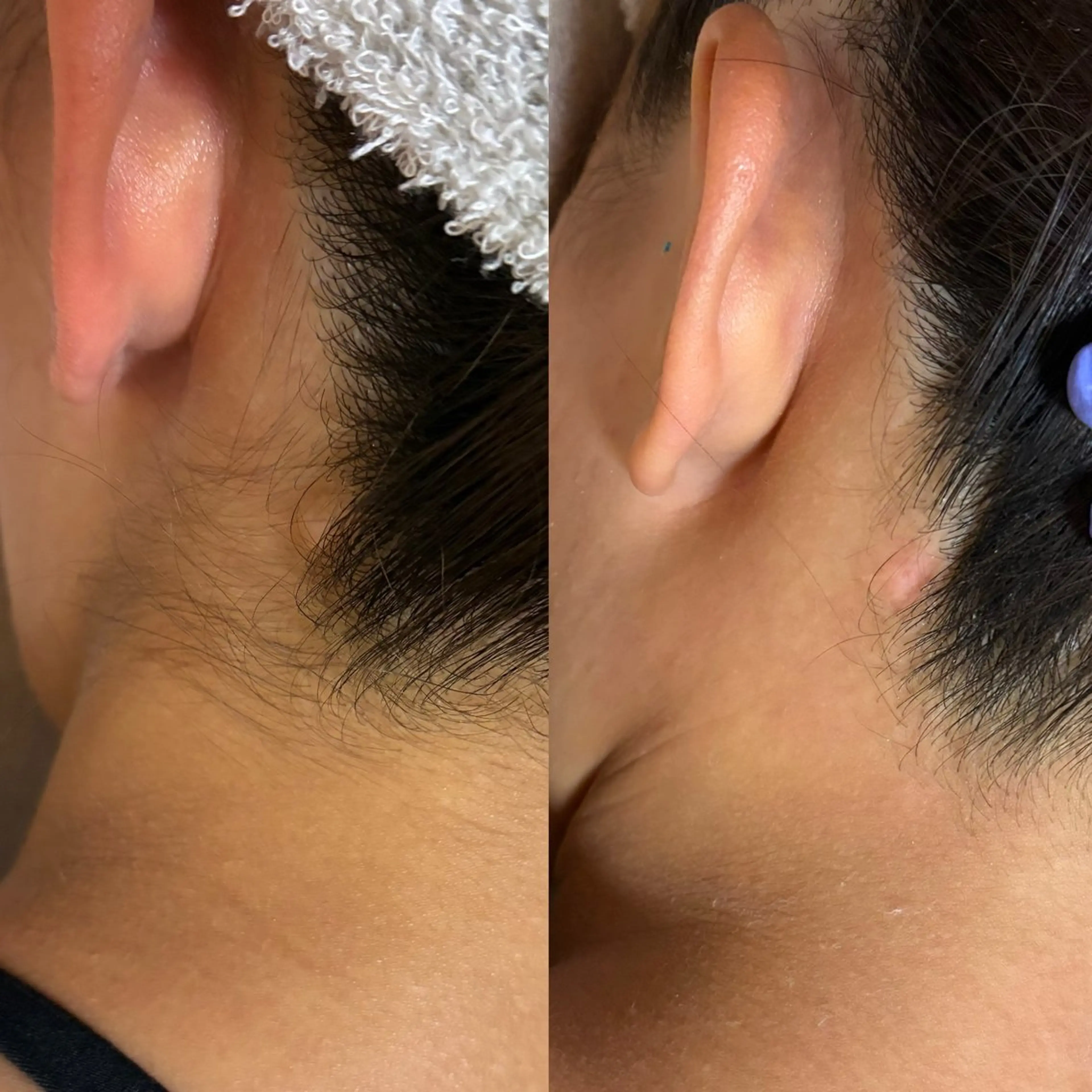 脱毛 高槻駅近/脱毛サロン【Salon Repo】所属・加代 結愛のエステ・リラクイメージ