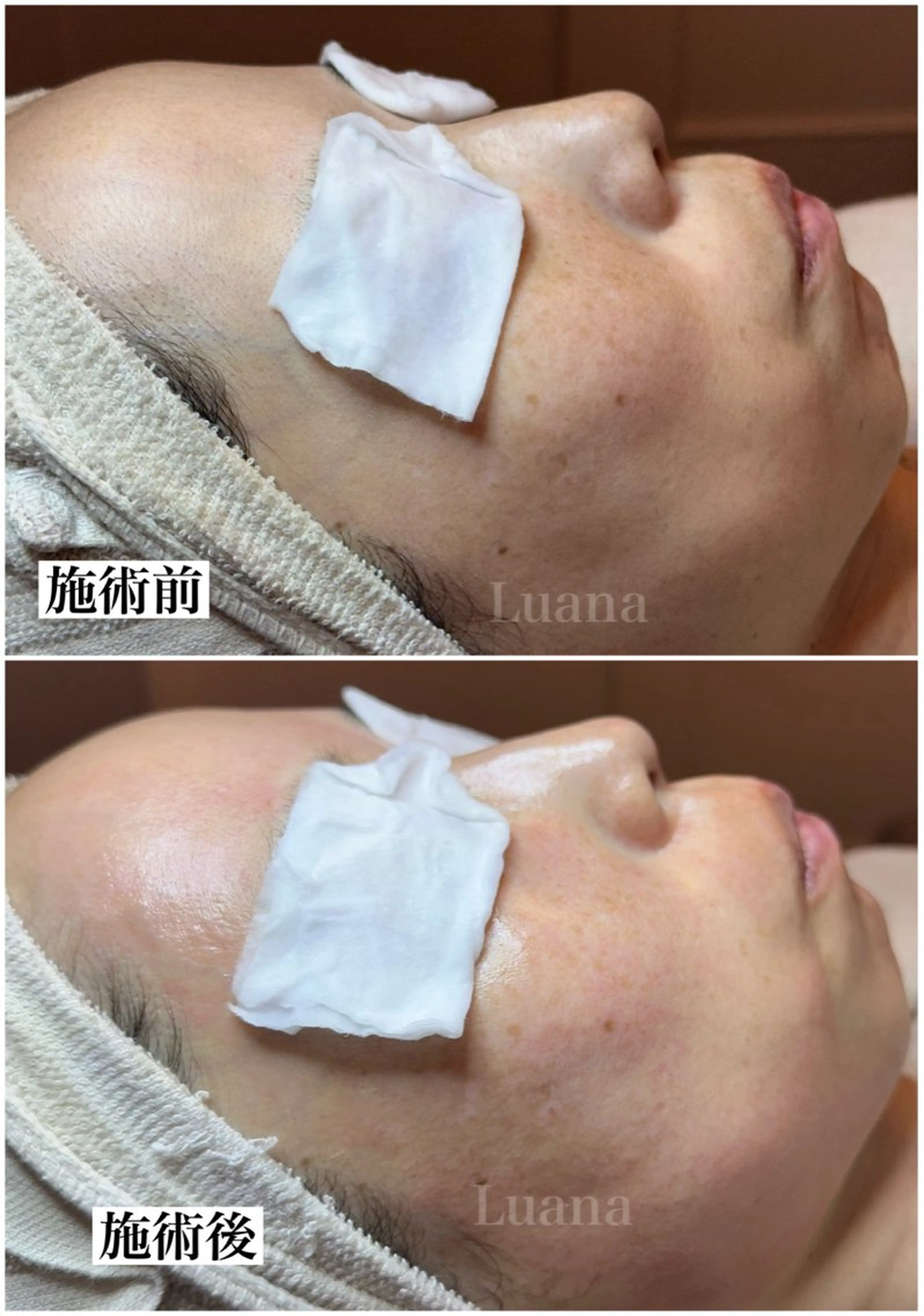 マツヤニWax専門/ 岸和田/Luanaのエステ・リラクイメージ