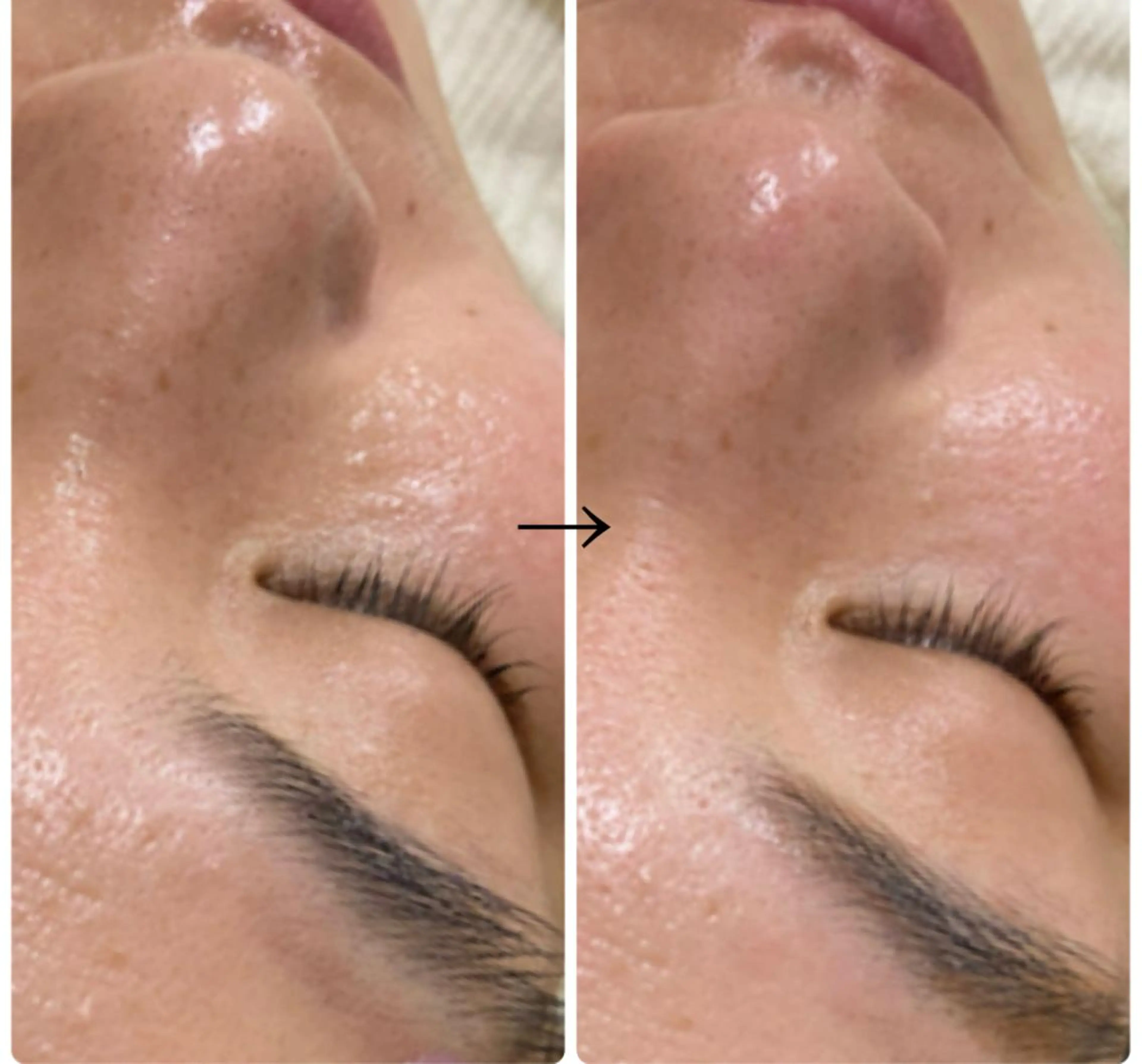 aroma  YURARI所属・韓国艶美人// 毛穴ケア🌹のエステ・リラクイメージ