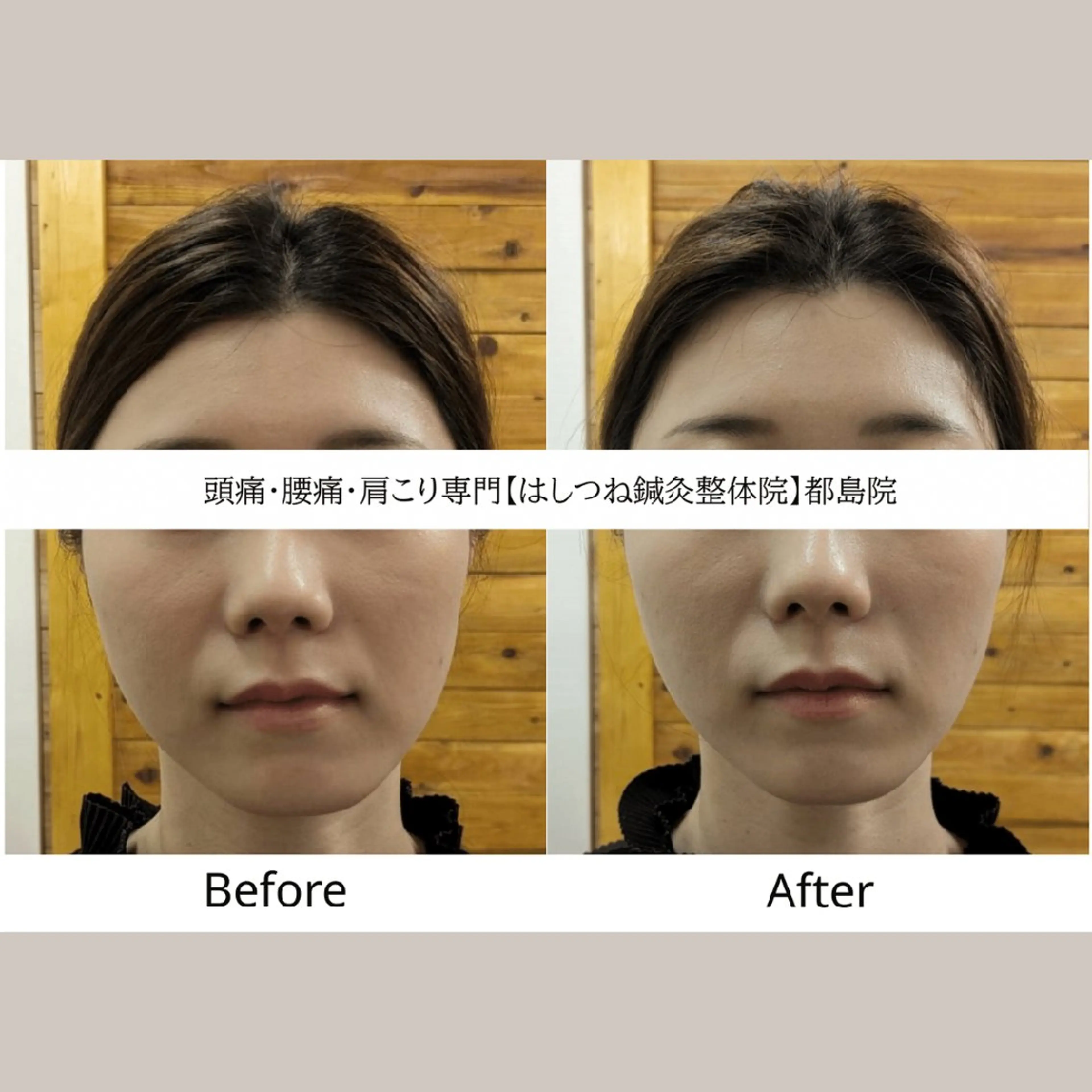 リラク 頭痛・腰痛・美容鍼に 特化してます。　橋岡のエステ・リラクイメージ