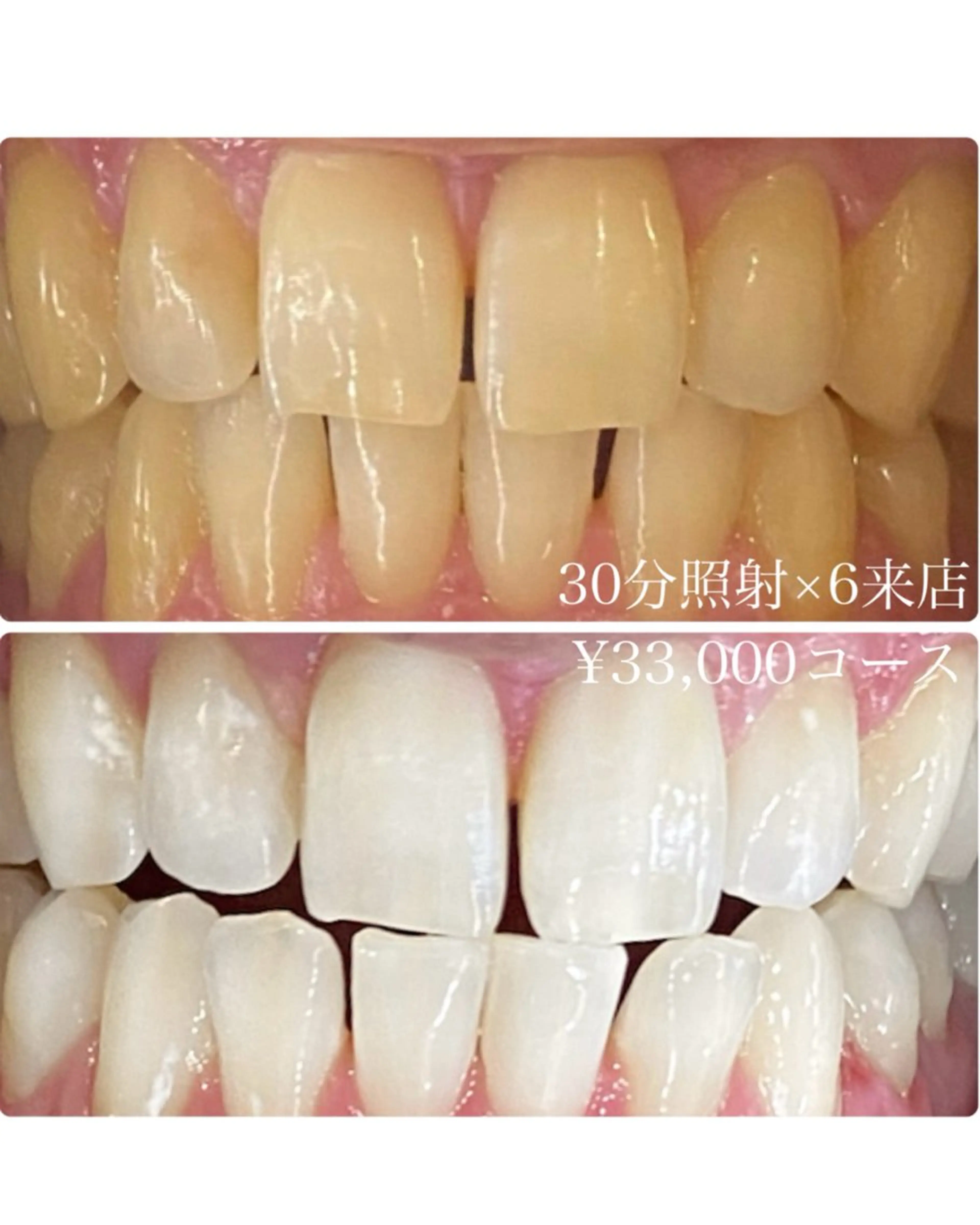 メンズ その他 ホワイトニングルーム　川崎店所属・ホワイトニング ルーム　川崎店のその他イメージ