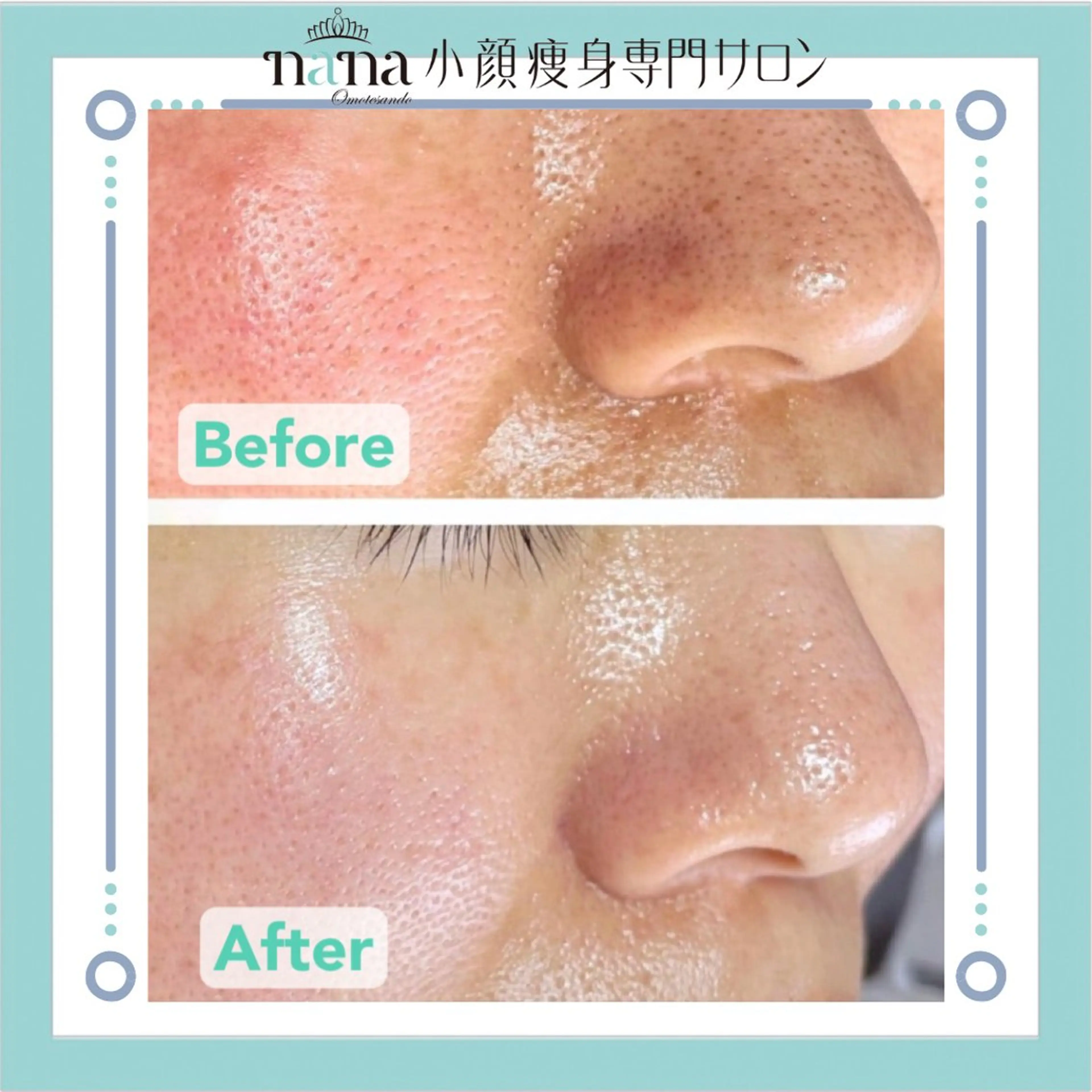 小顔痩身インディバ Nana表参道のエステ・リラクイメージ