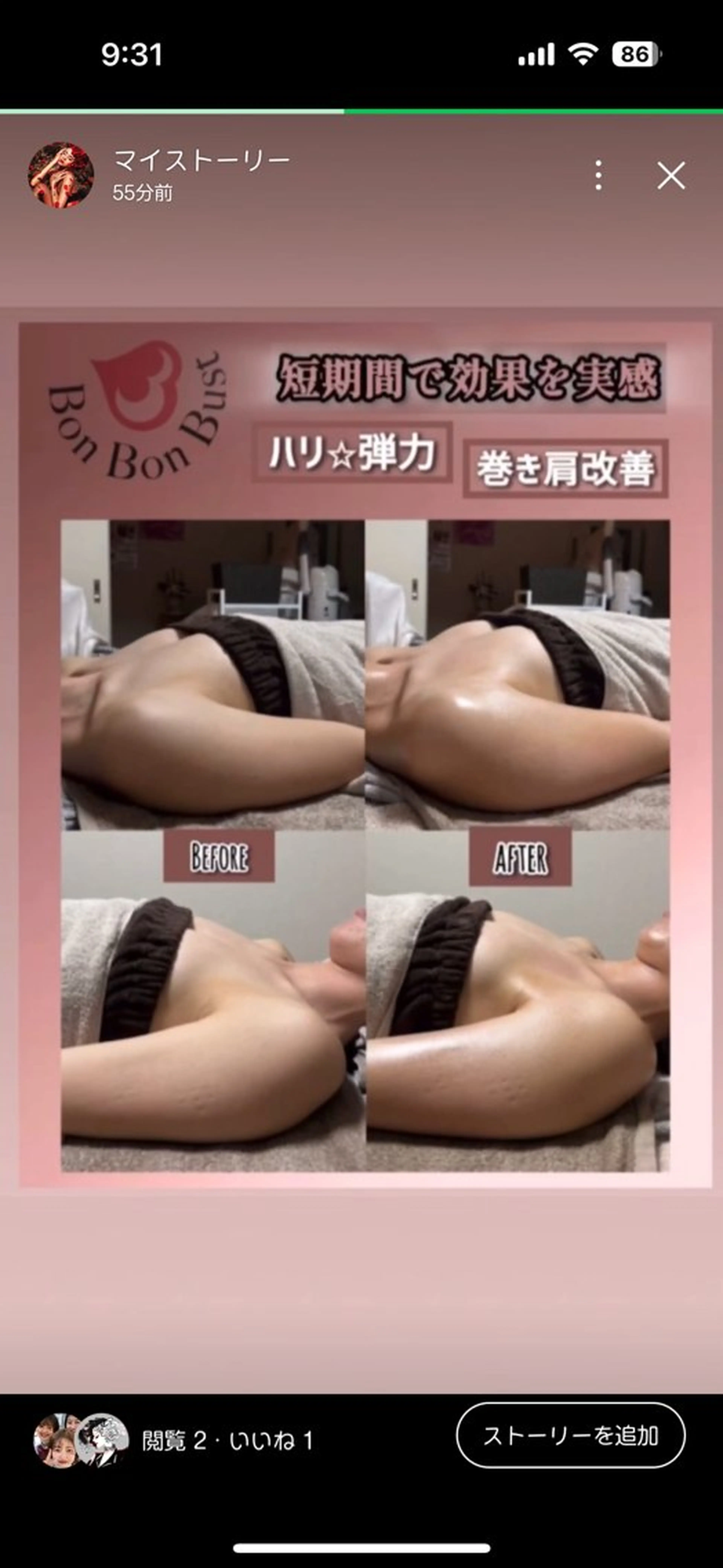 エステ ヴィーナス ビューティーのエステ・リラクイメージ