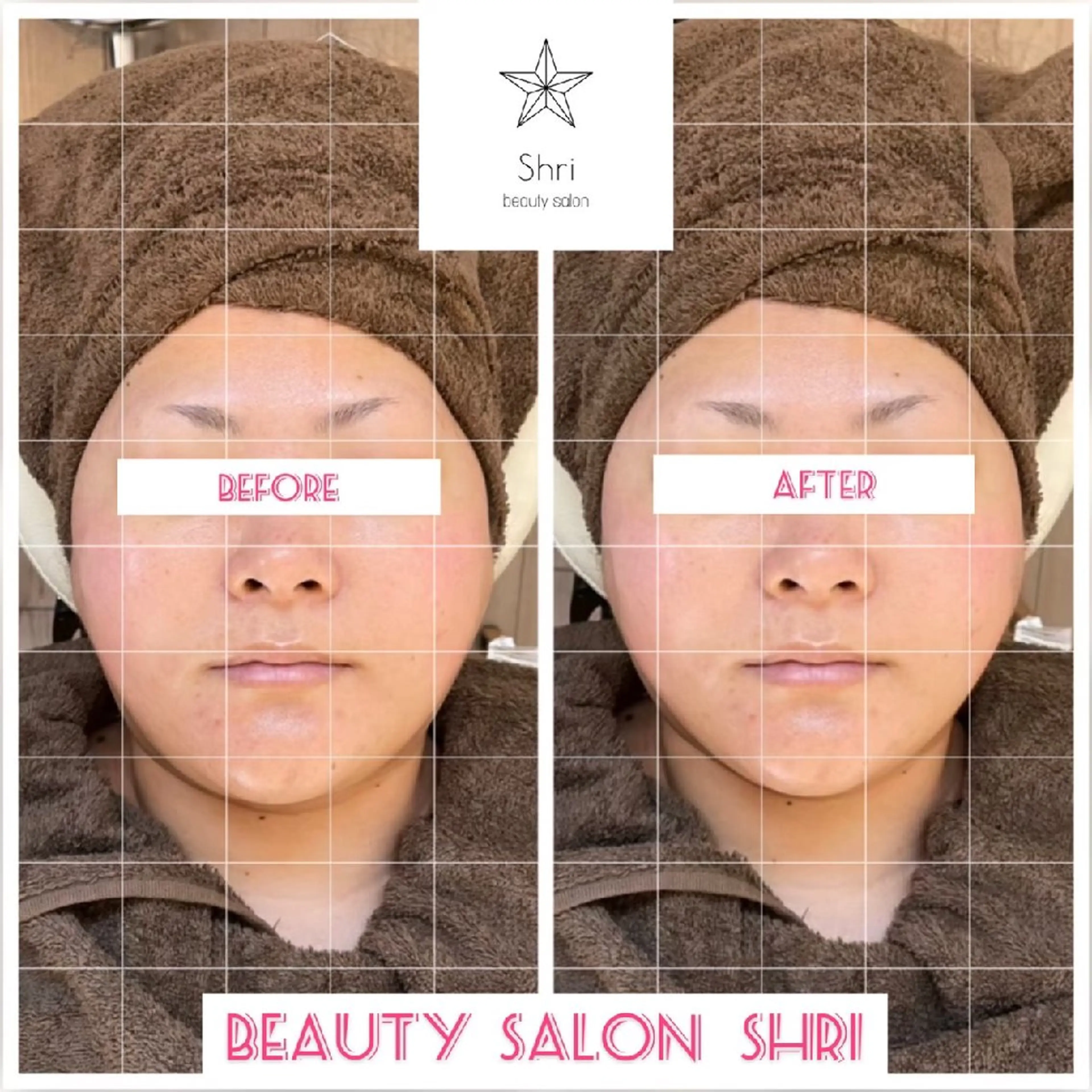 salon Lewis Addict所属・ルイスアディクト 名駅店のエステ・リラクイメージ