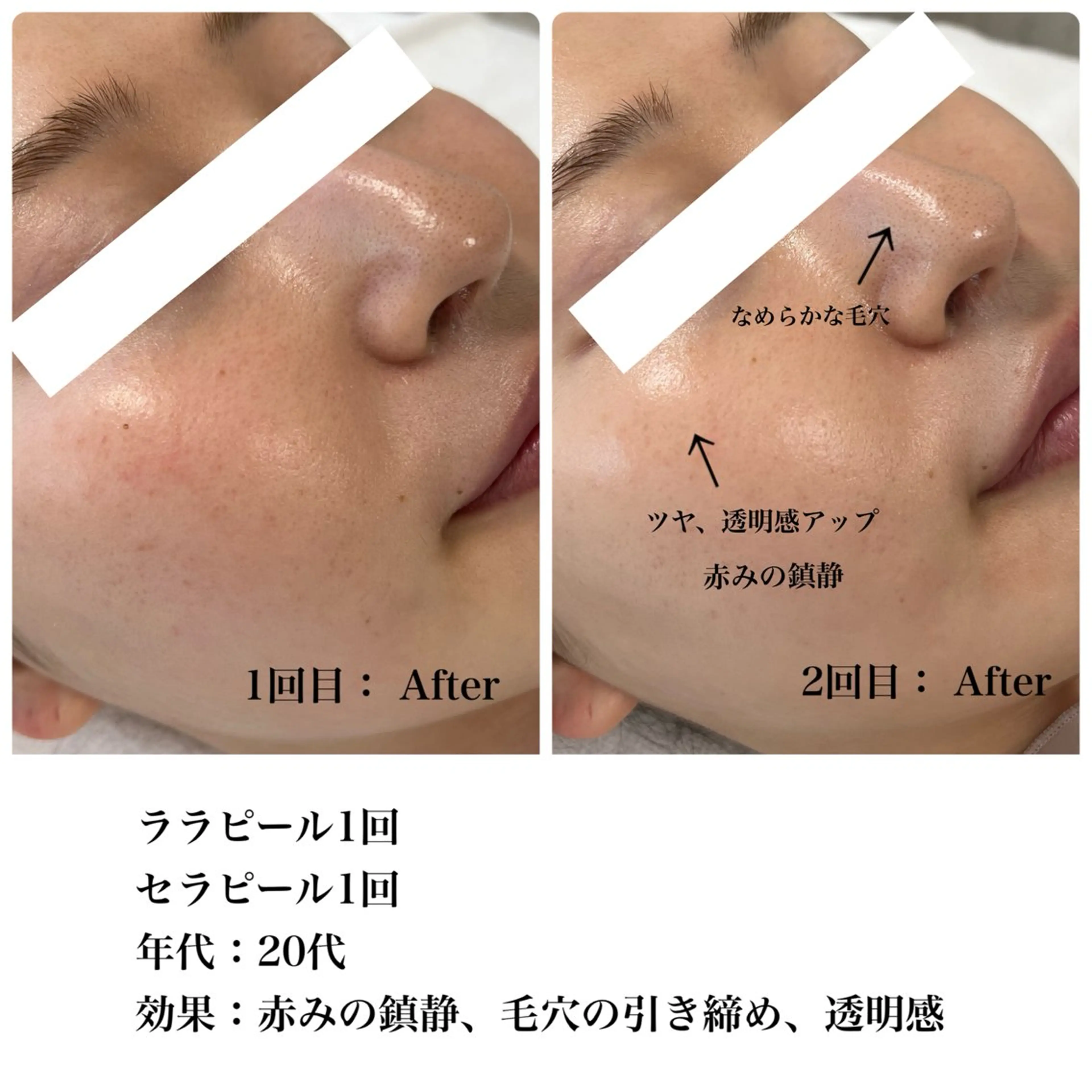 Astorie SHIORIのエステ・リラクイメージ