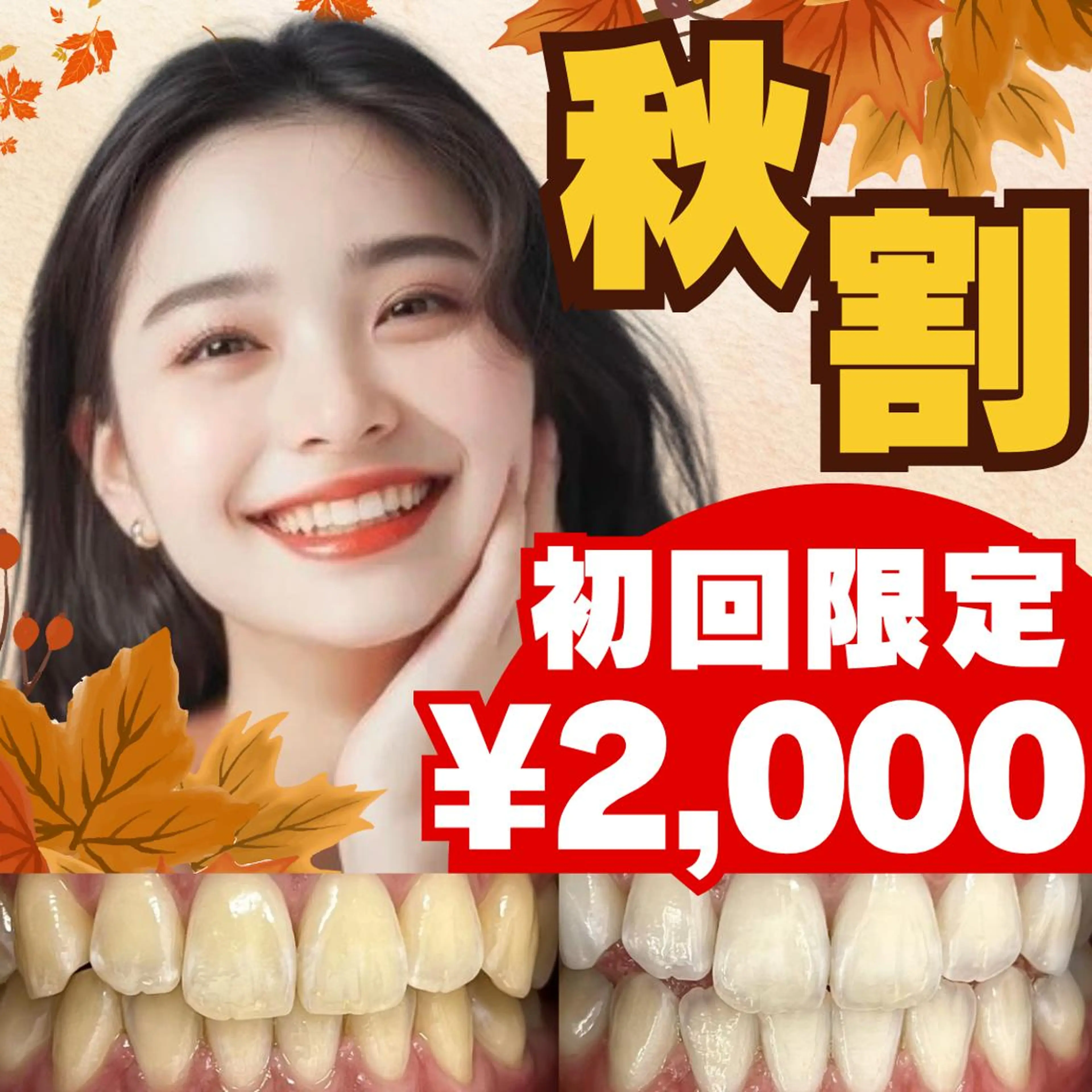 【🍁11月限定💛秋割🍁】8分照射×2回の定番メニュー💎お手軽セルフホワイトニングで理想の白い歯に☺️の写真