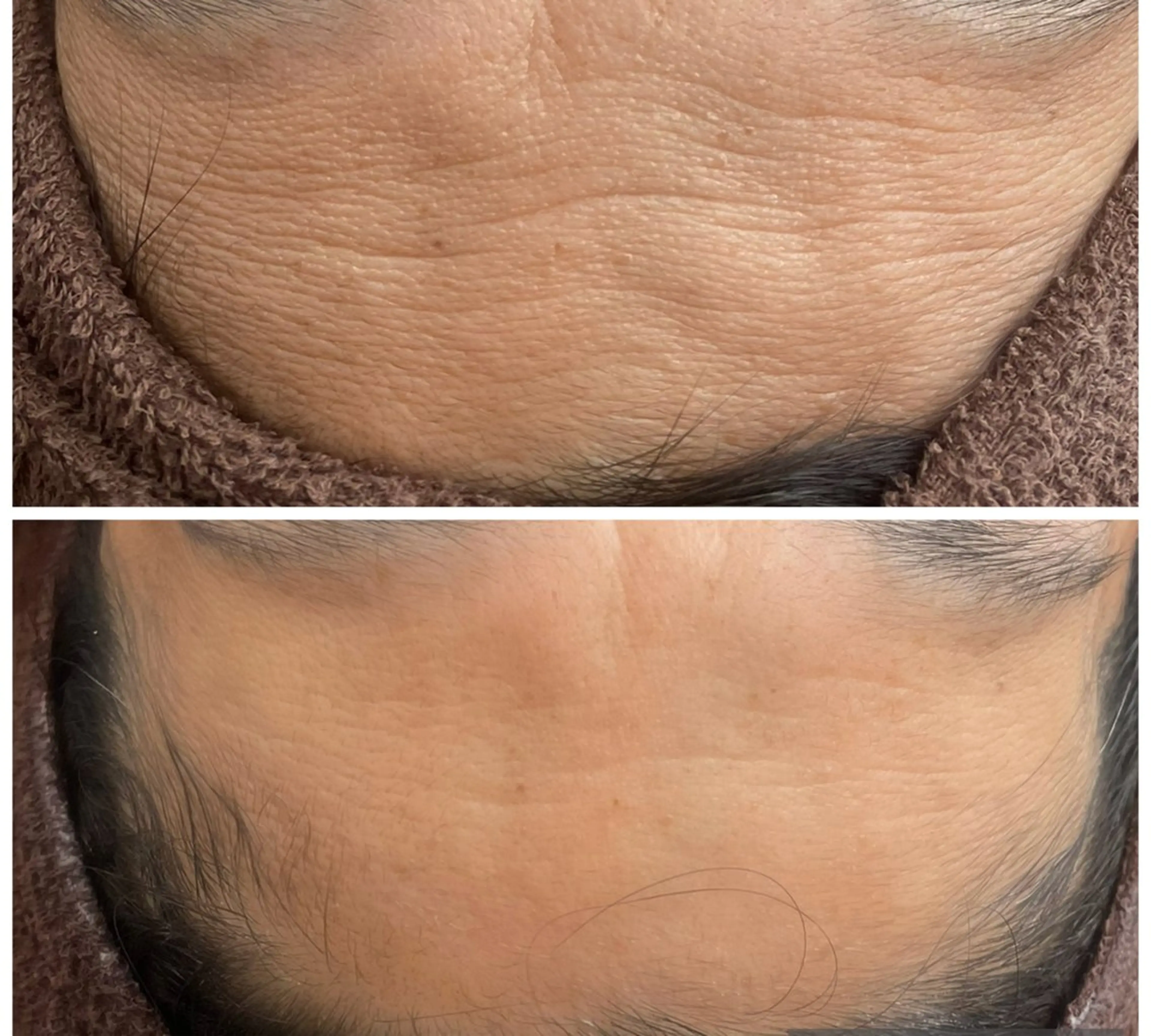 エステ サロン　Ambelle所属・北川 亜友美のエステ・リラクイメージ