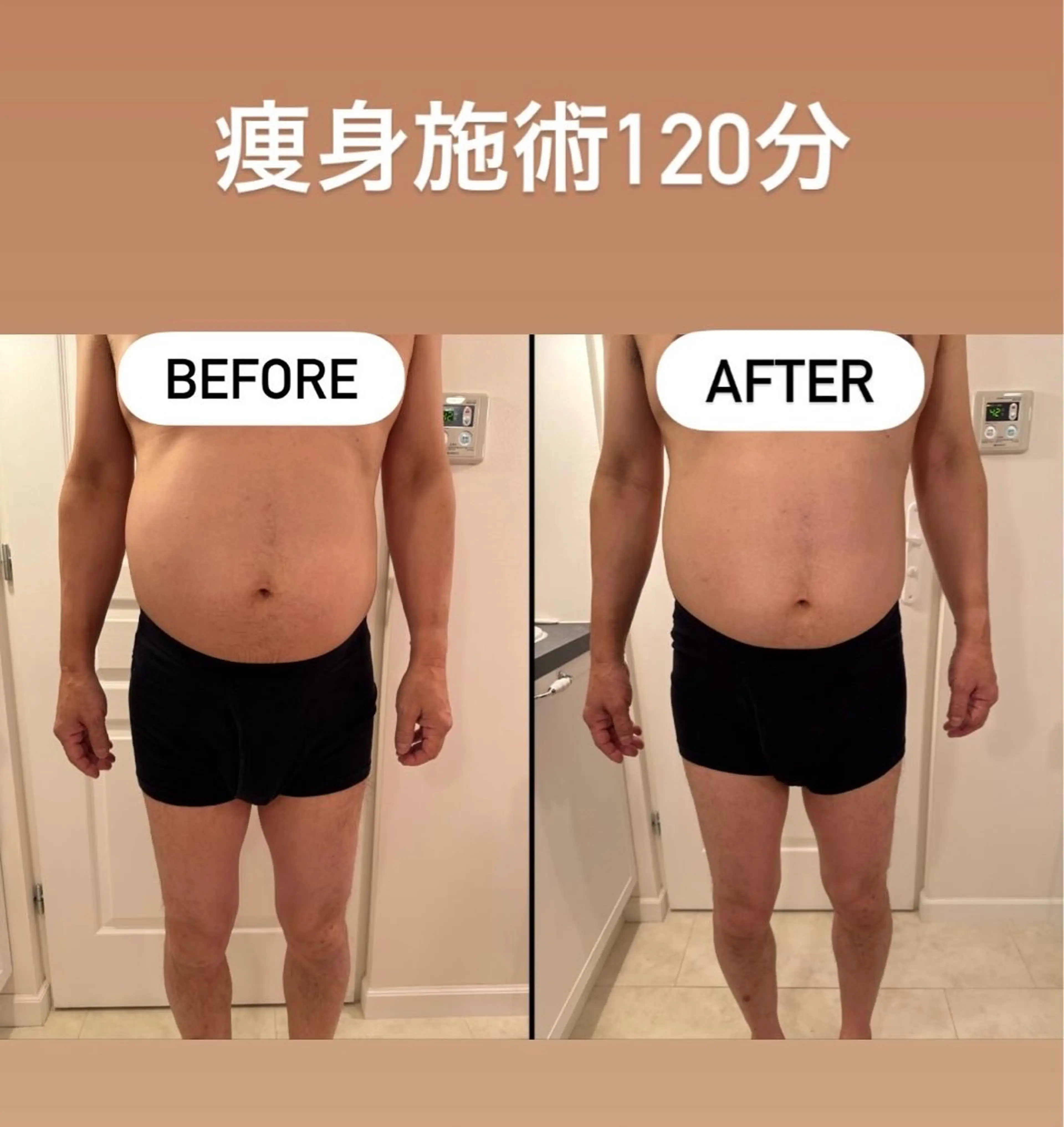 最新機器を使用した痩身エステの写真