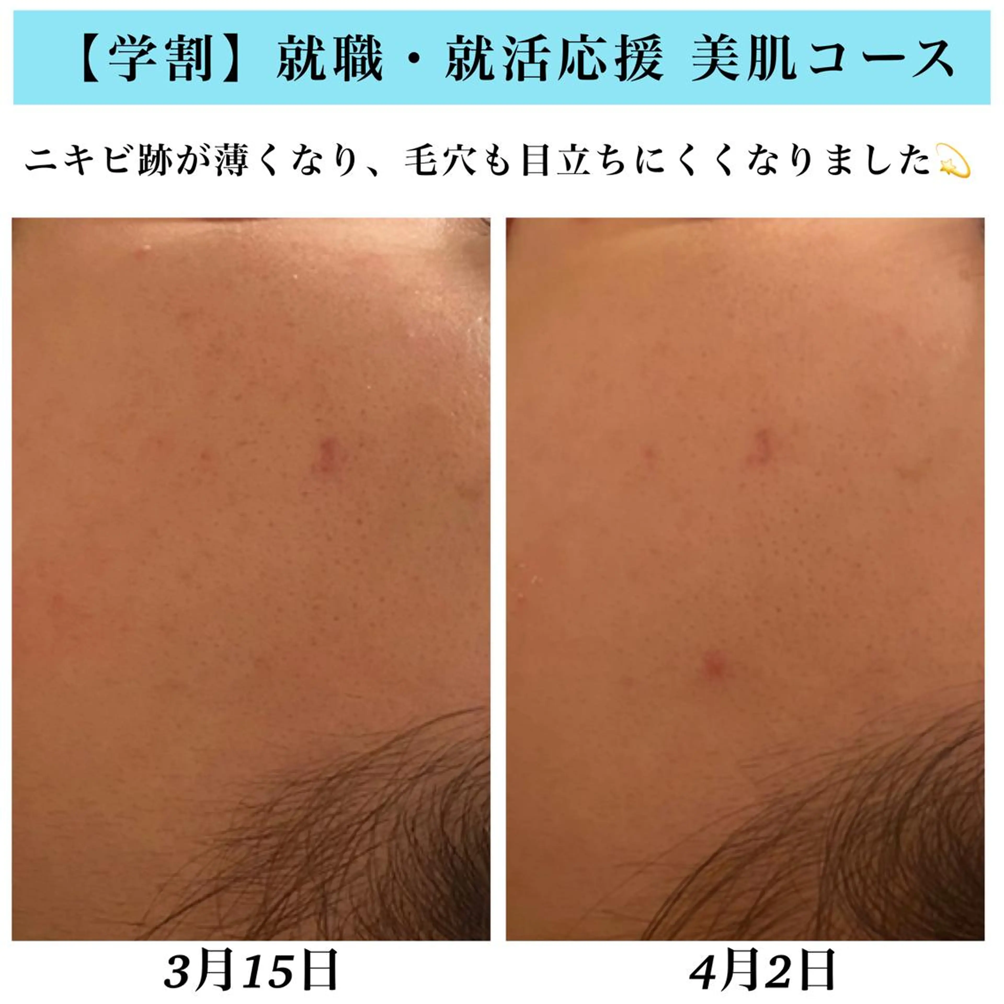 エステ Bellesthe （ベルエステ）のエステ・リラクイメージ