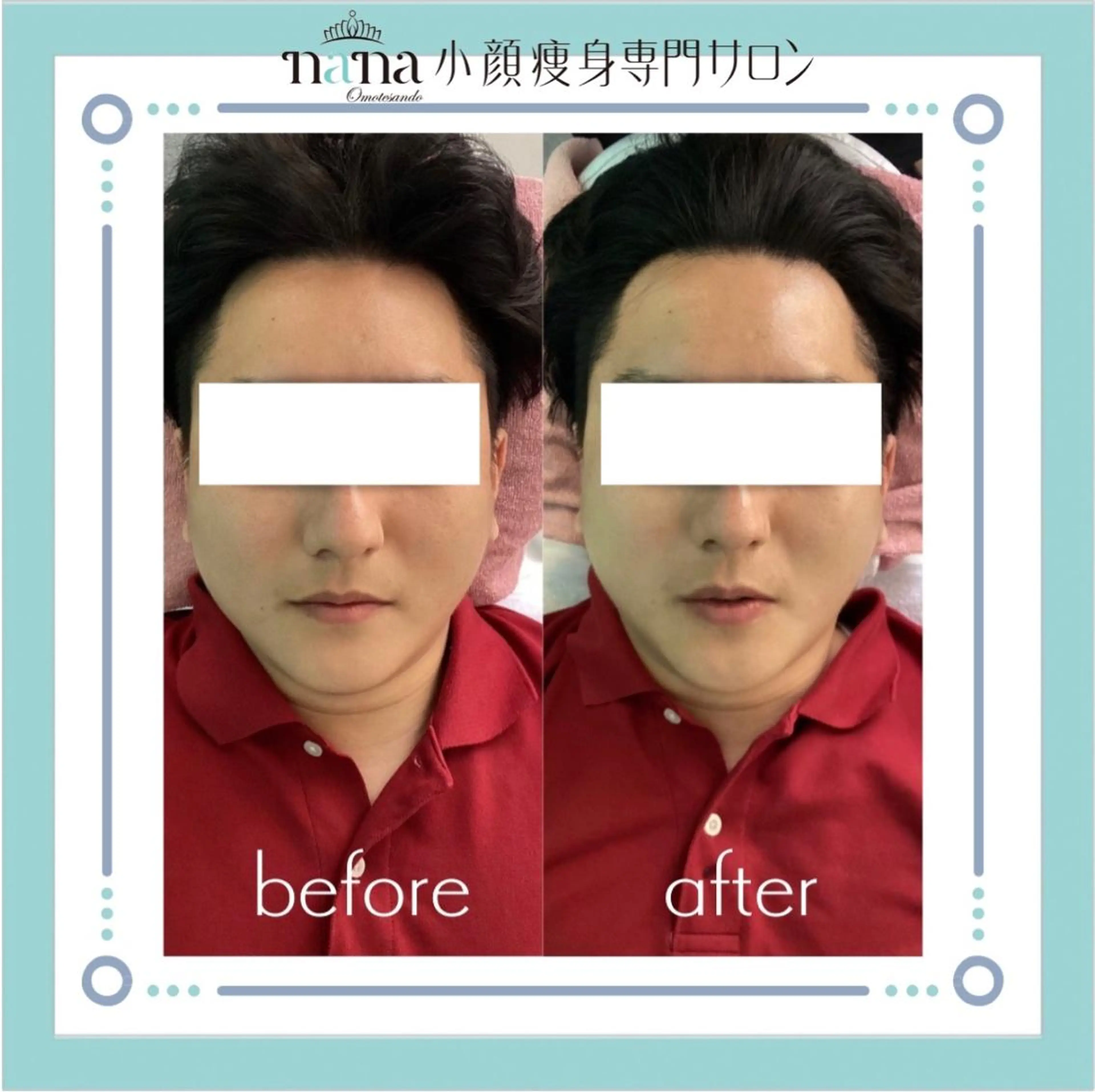 メンズ 小顔痩身インディバ Nana表参道のエステ・リラクイメージ