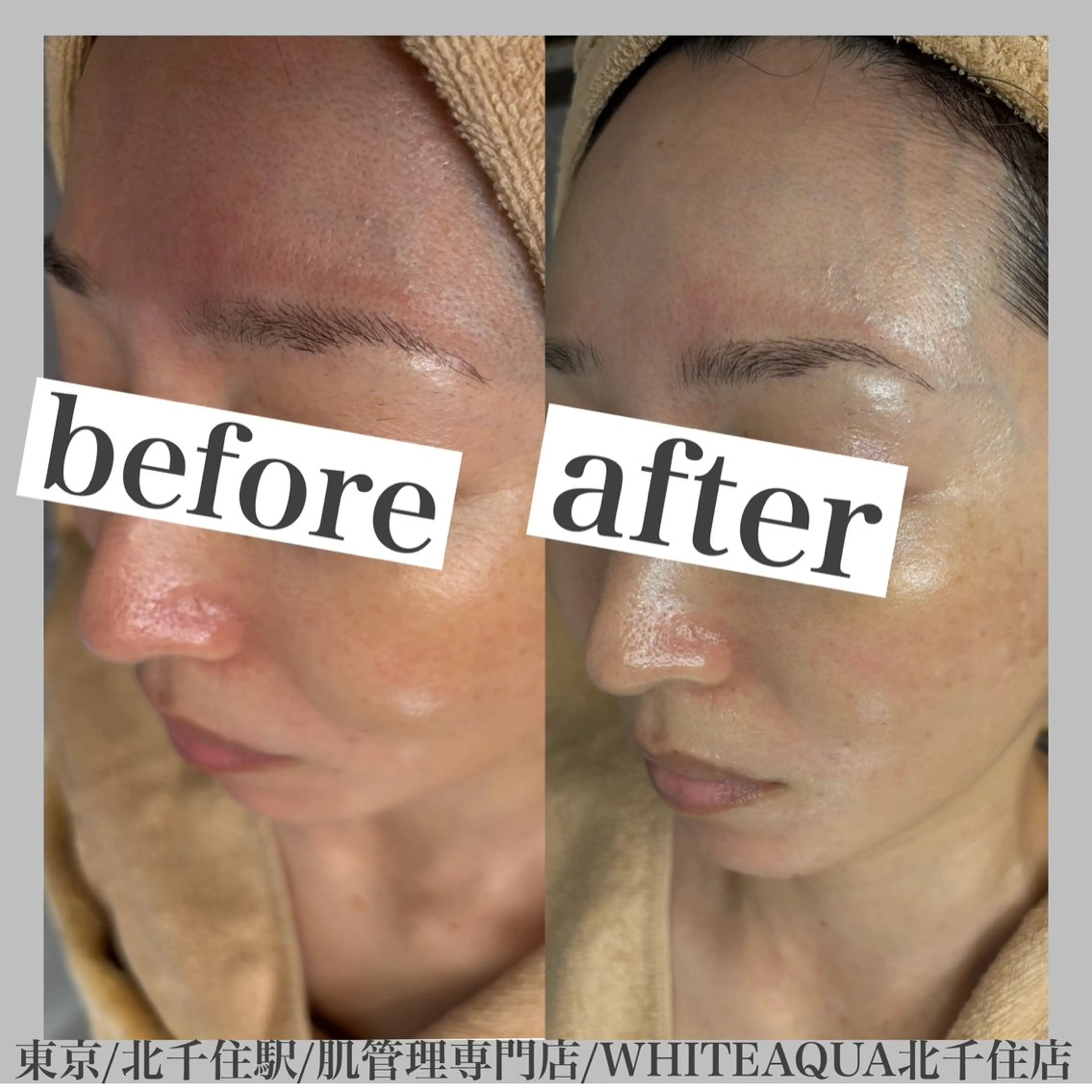 WHITE AQUA 北千住店のエステ・リラクイメージ