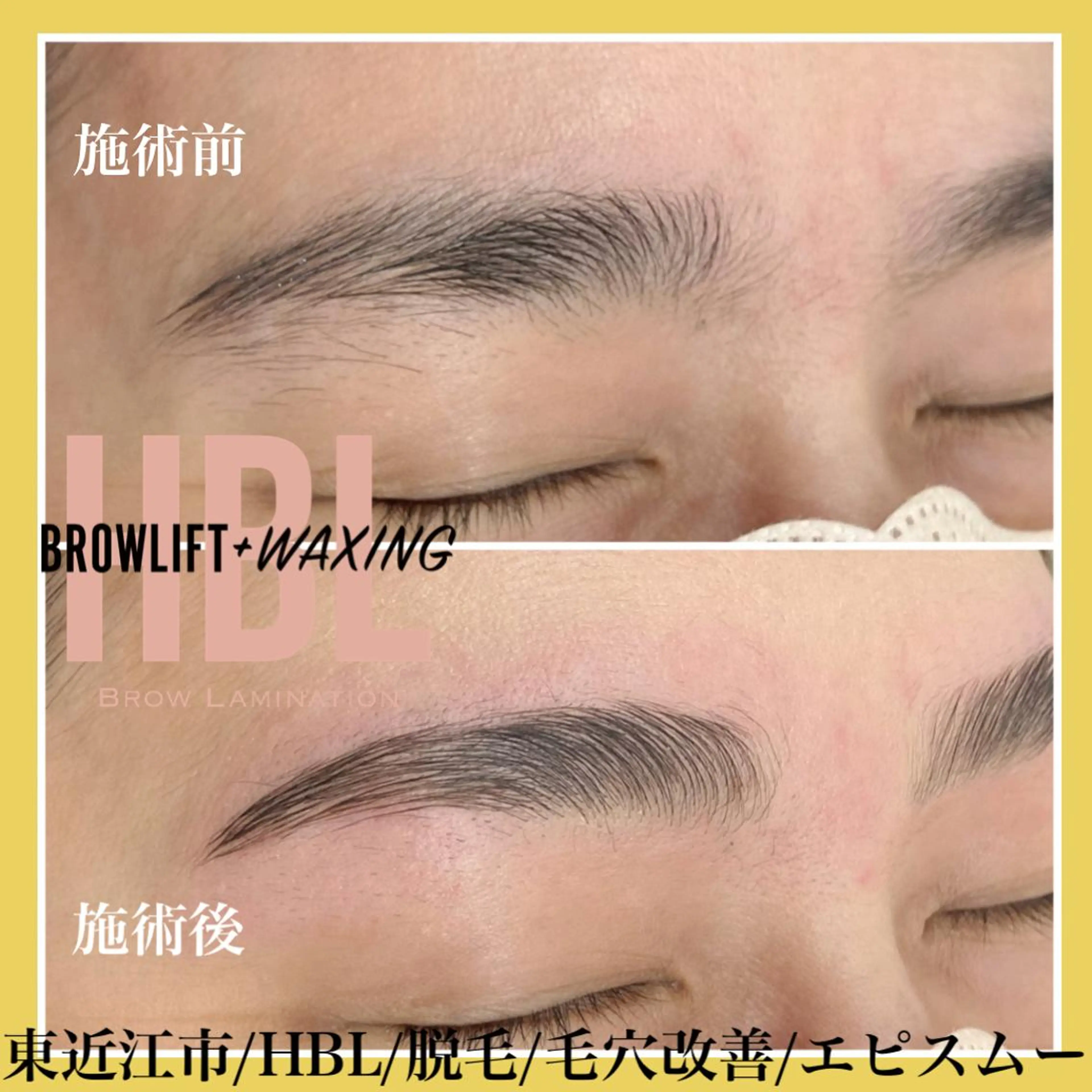 アイブロウ epismoo 脱毛/HBL/毛穴の眉毛・アイブロウイメージ