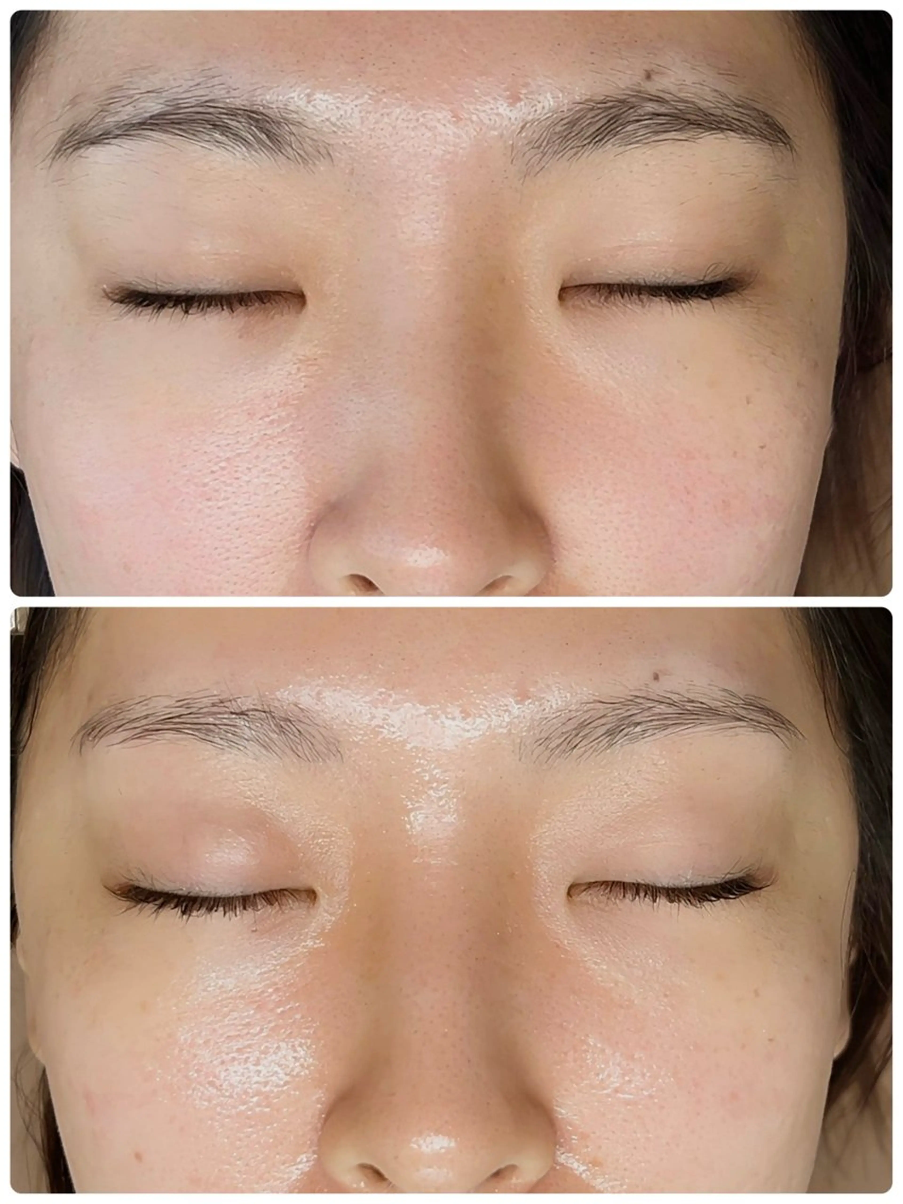 Wiqoピーリングの写真