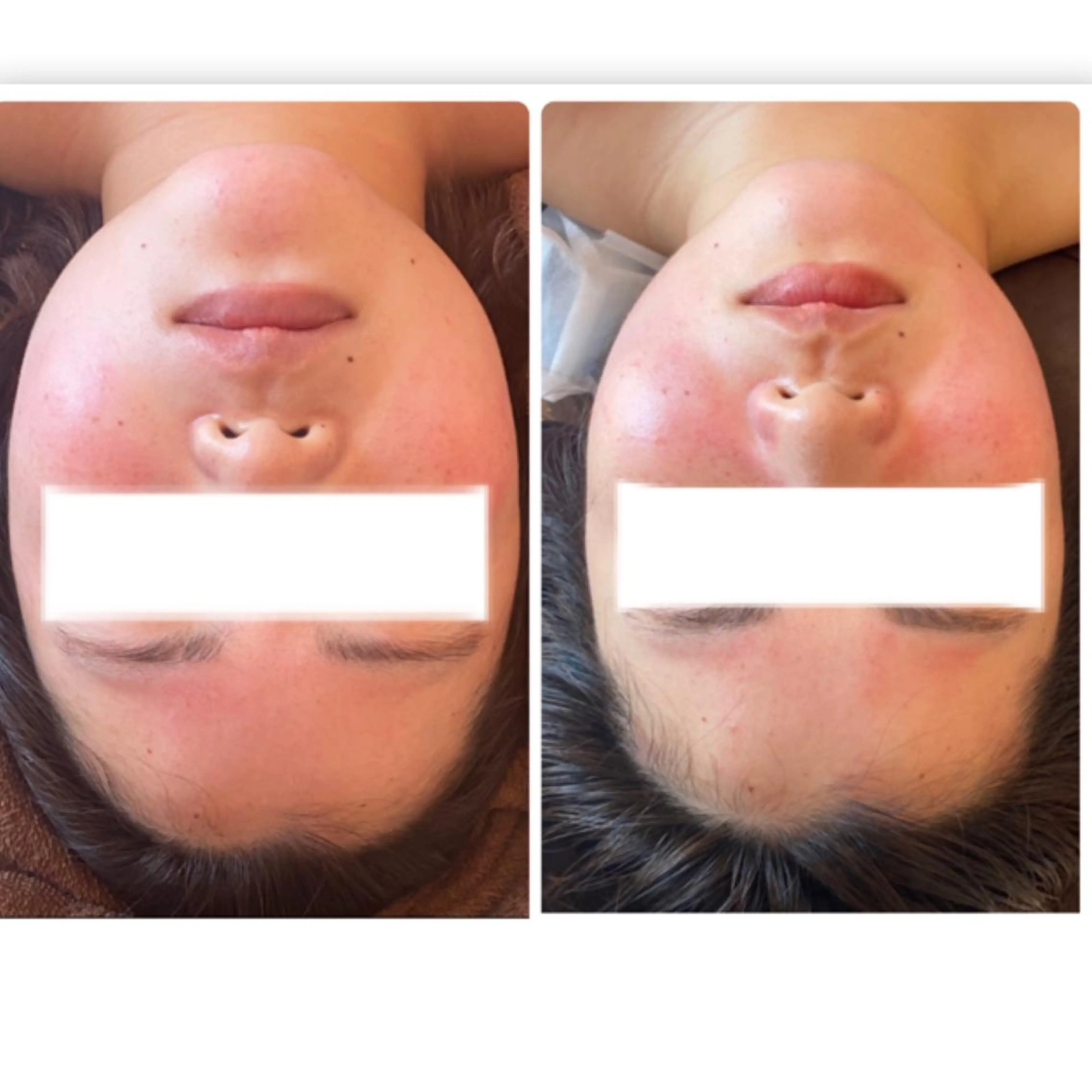 FLEUR大阪・整体 ・ハイフ・痩身・小顔のエステ・リラクイメージ