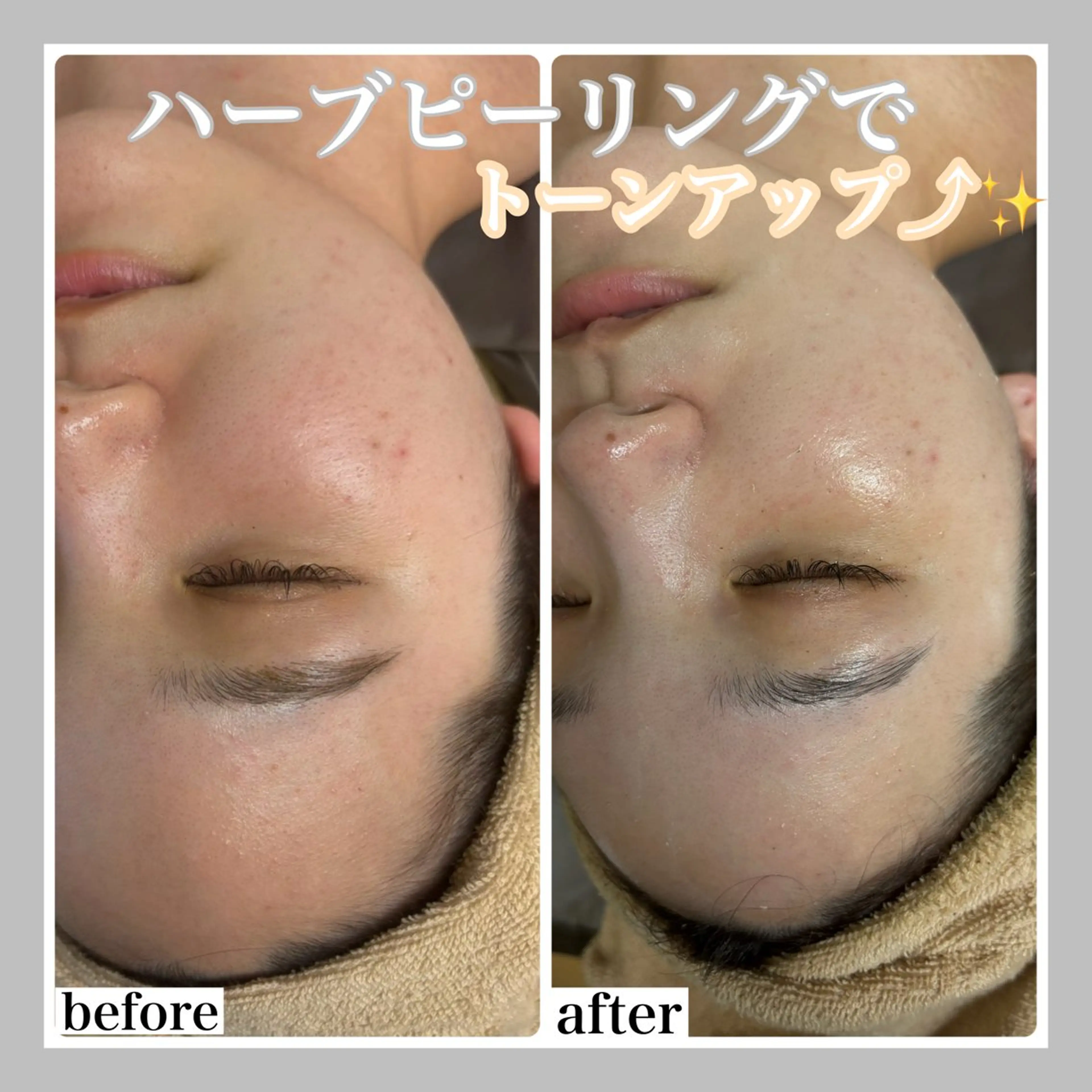 エステ WHITE AQUA 北千住店のエステ・リラクイメージ