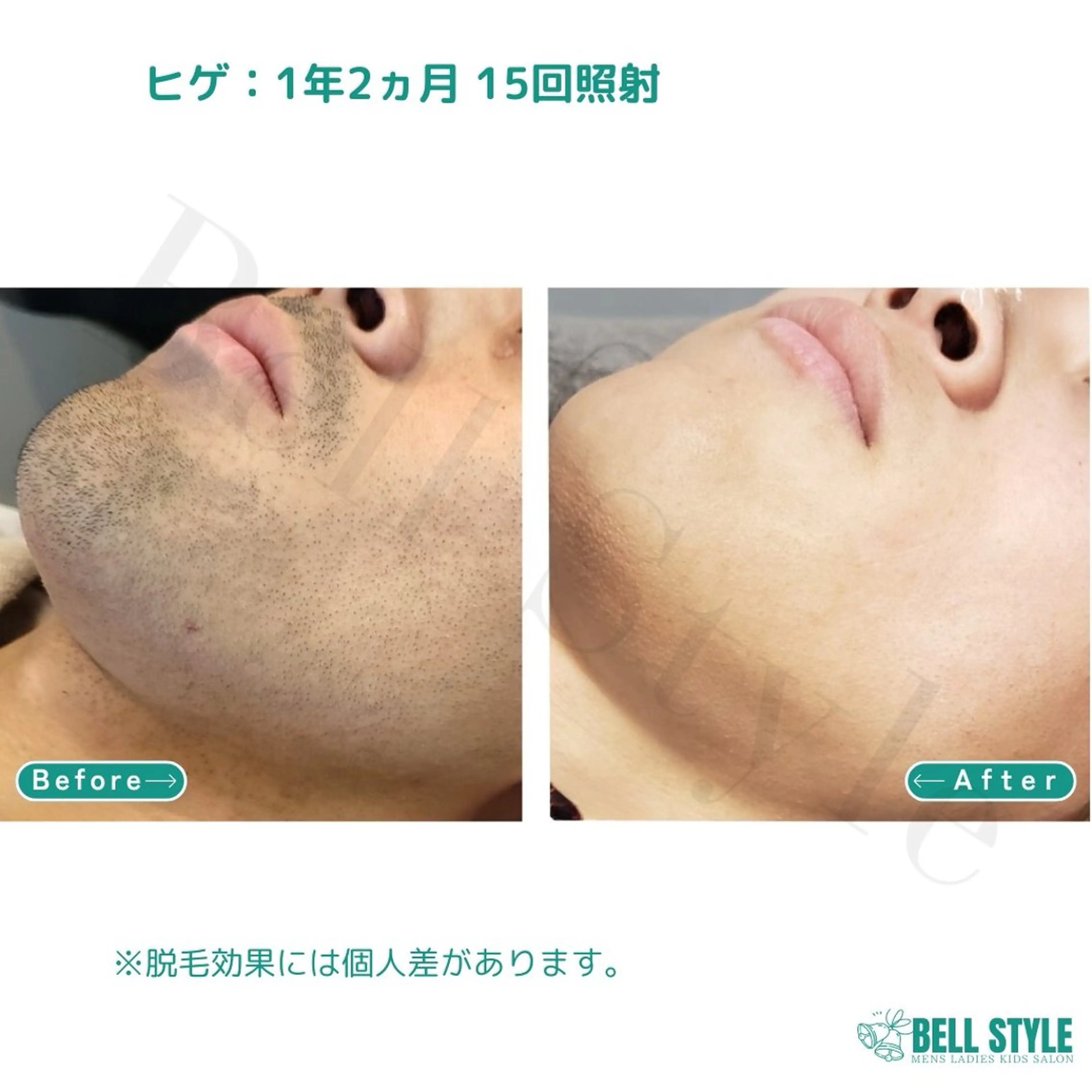 メンズ メンズ&レディース　Bell style所属・【脱毛・美肌専門】 bellstyleのエステ・リラクイメージ