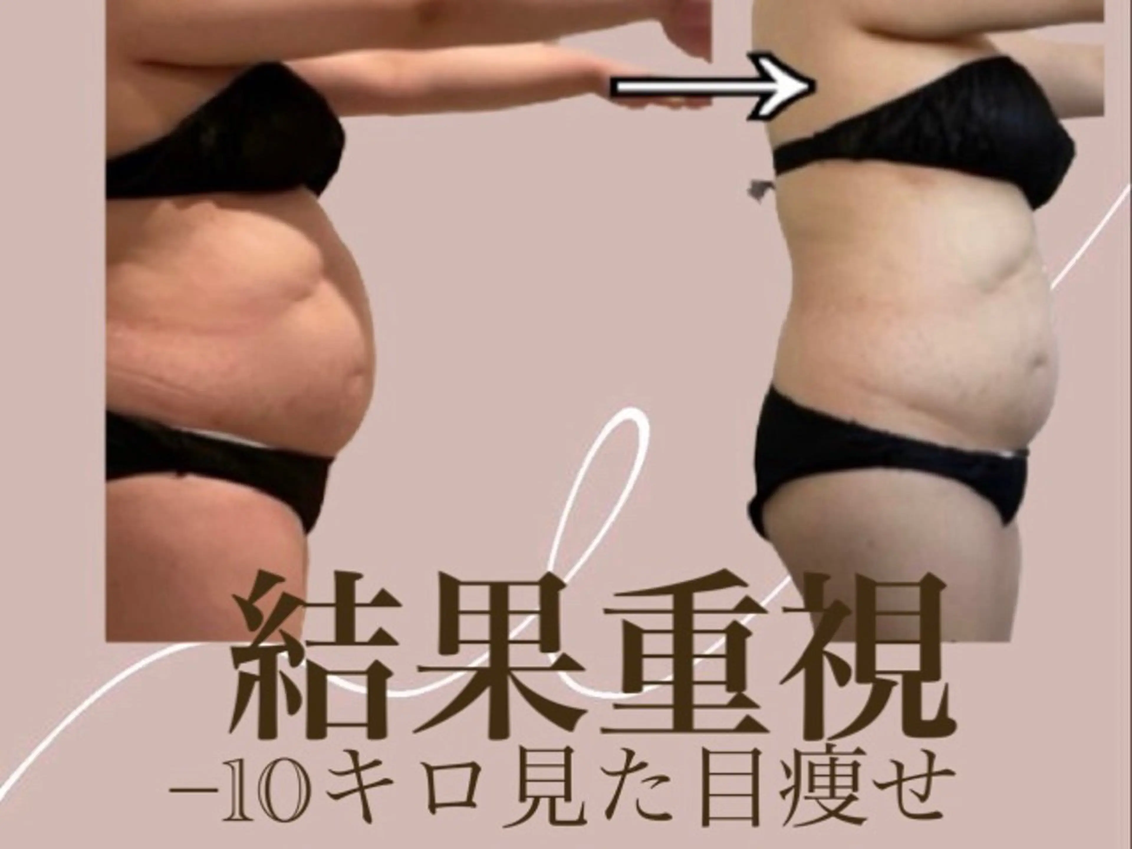 ¥6000お得🉐【限定！全身痩身！美肌・小顔効果も】トータルプレミアムコース★¥ 13800→¥7800の写真