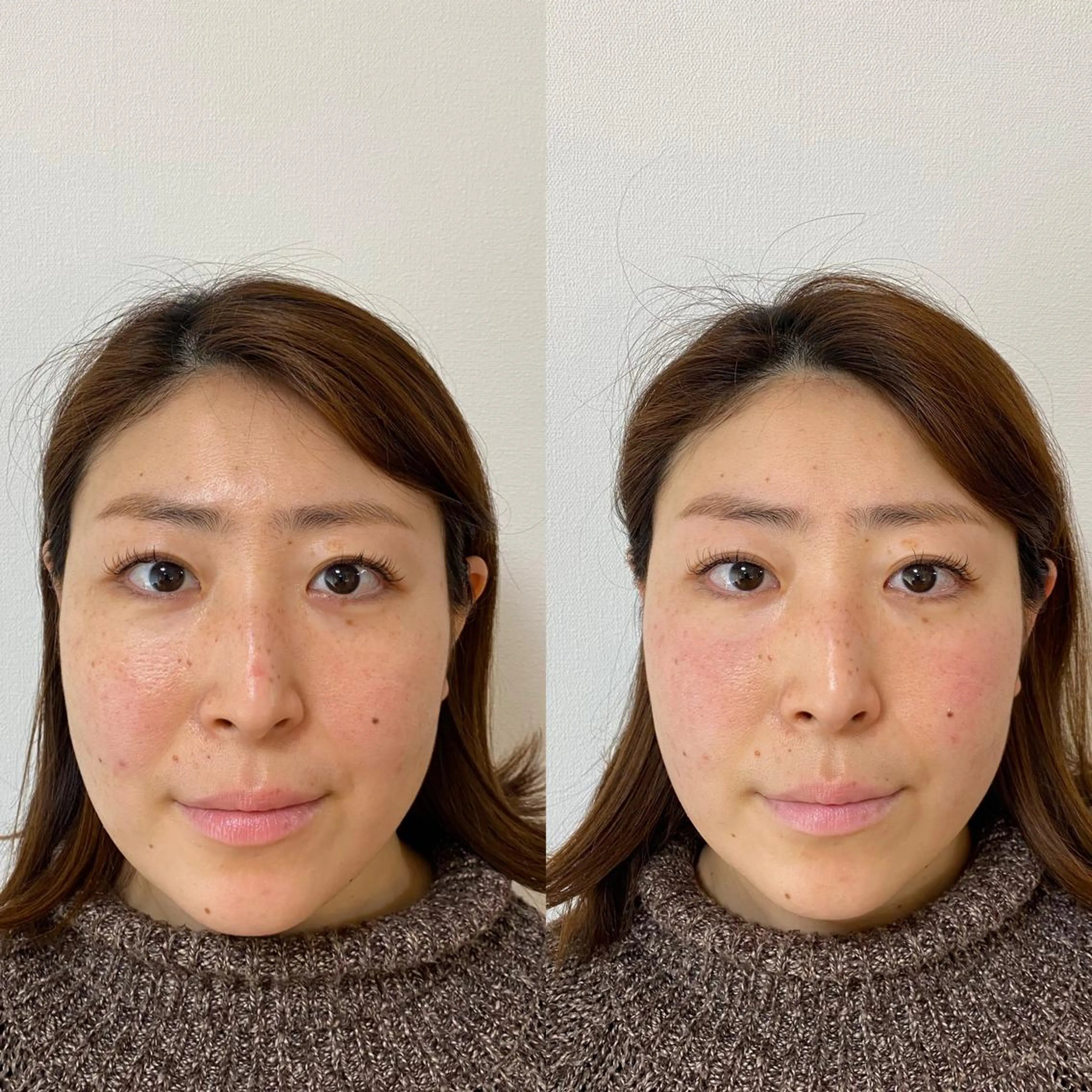 美容鍼灸+全身ゆるゆる整体(ワンポイントリーディング付き)の写真