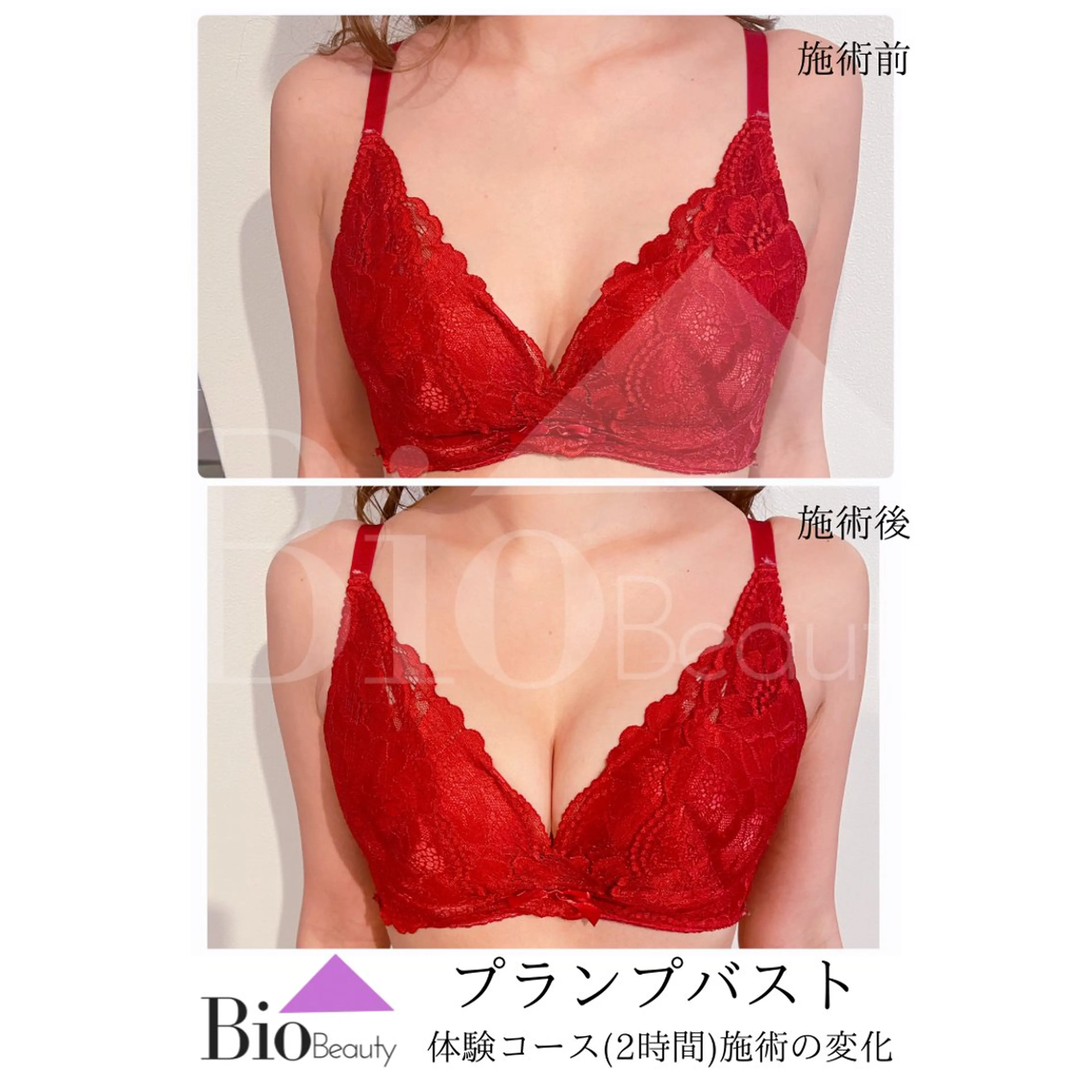 エステ Bio Beauty 神戸本店所属・エステ豊胸マイスター 中前のエステ・リラクイメージ