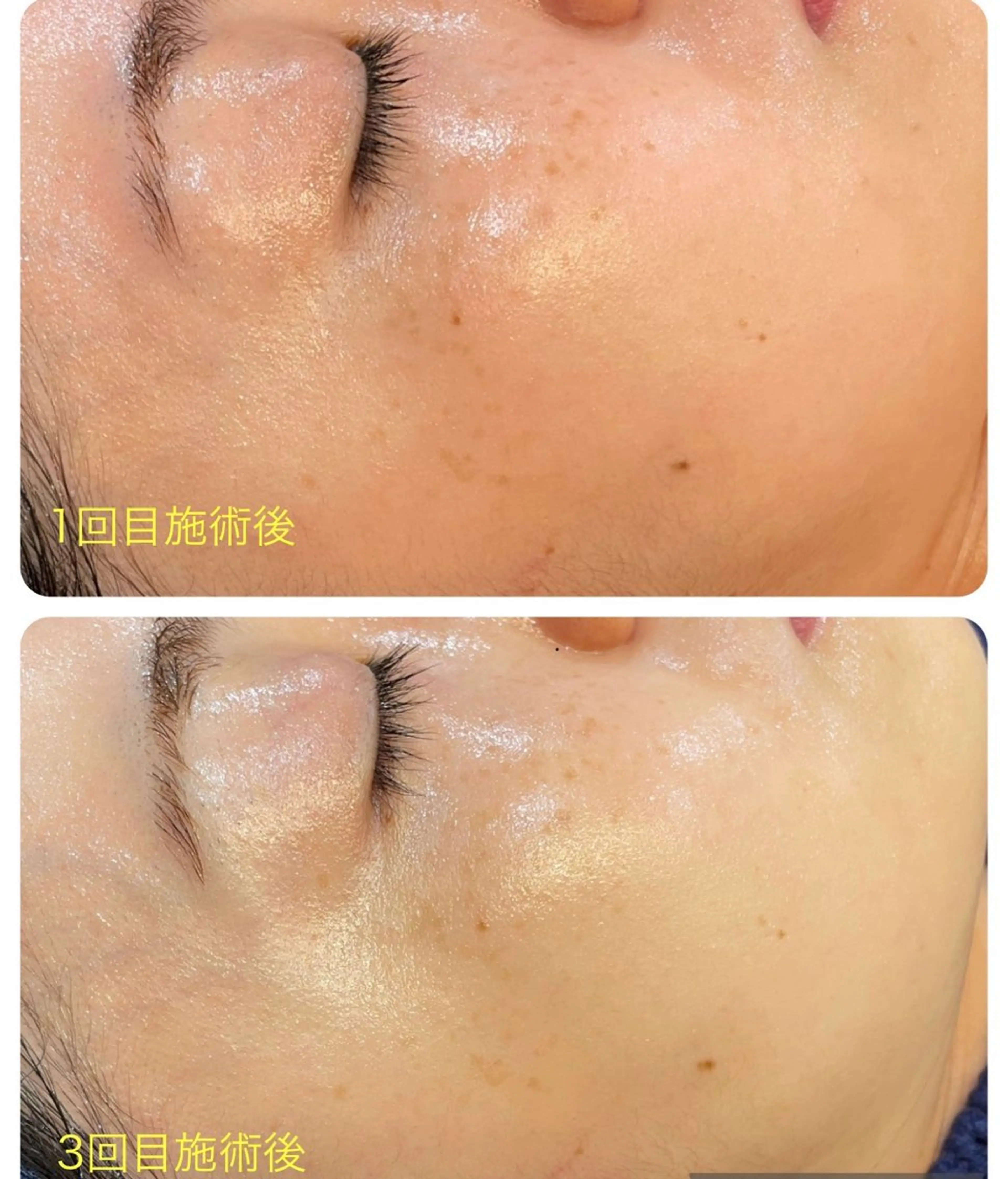 エステ leolo武蔵浦和 肌質改善＆脱毛のエステ・リラクイメージ