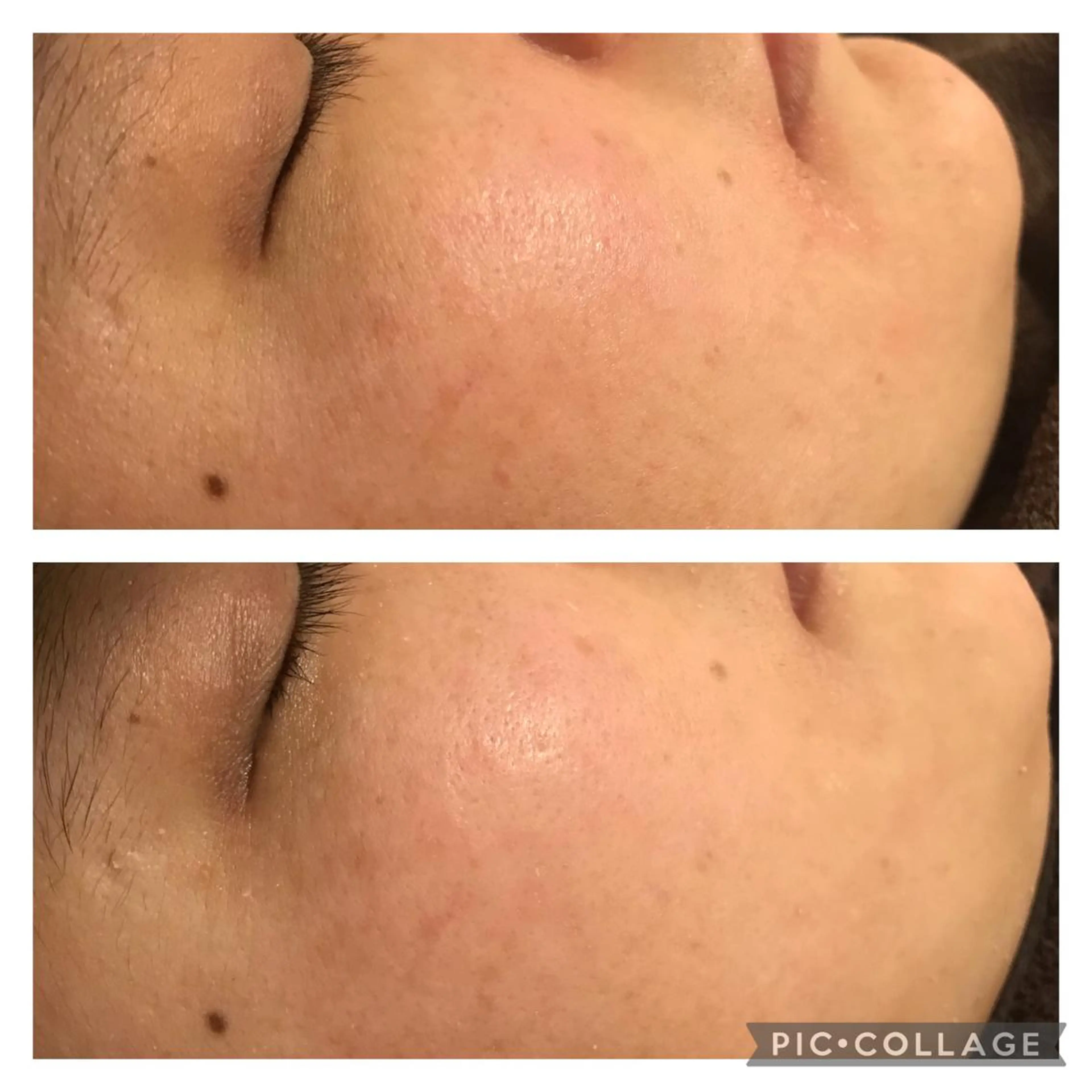 ショート カラー パーマ ヘアアレンジ メンズ キッズ ネイル マツエク・マツパ アイブロウ アニメ,Vオタク× 即効痩せエステサロンのエステ・リラクイメージ