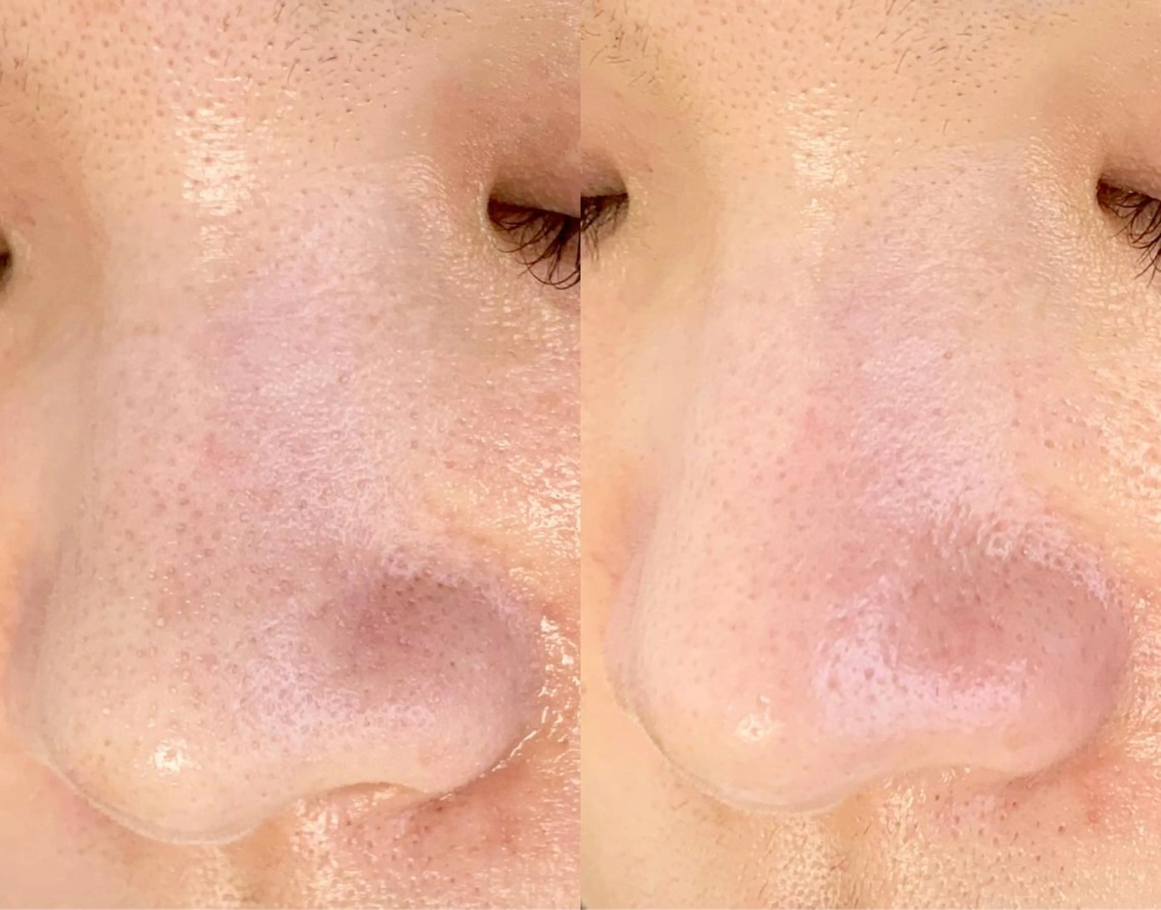 メンズ エステ salonLADYSTYLE所属・稲嶺 美華のエステ・リラクイメージ