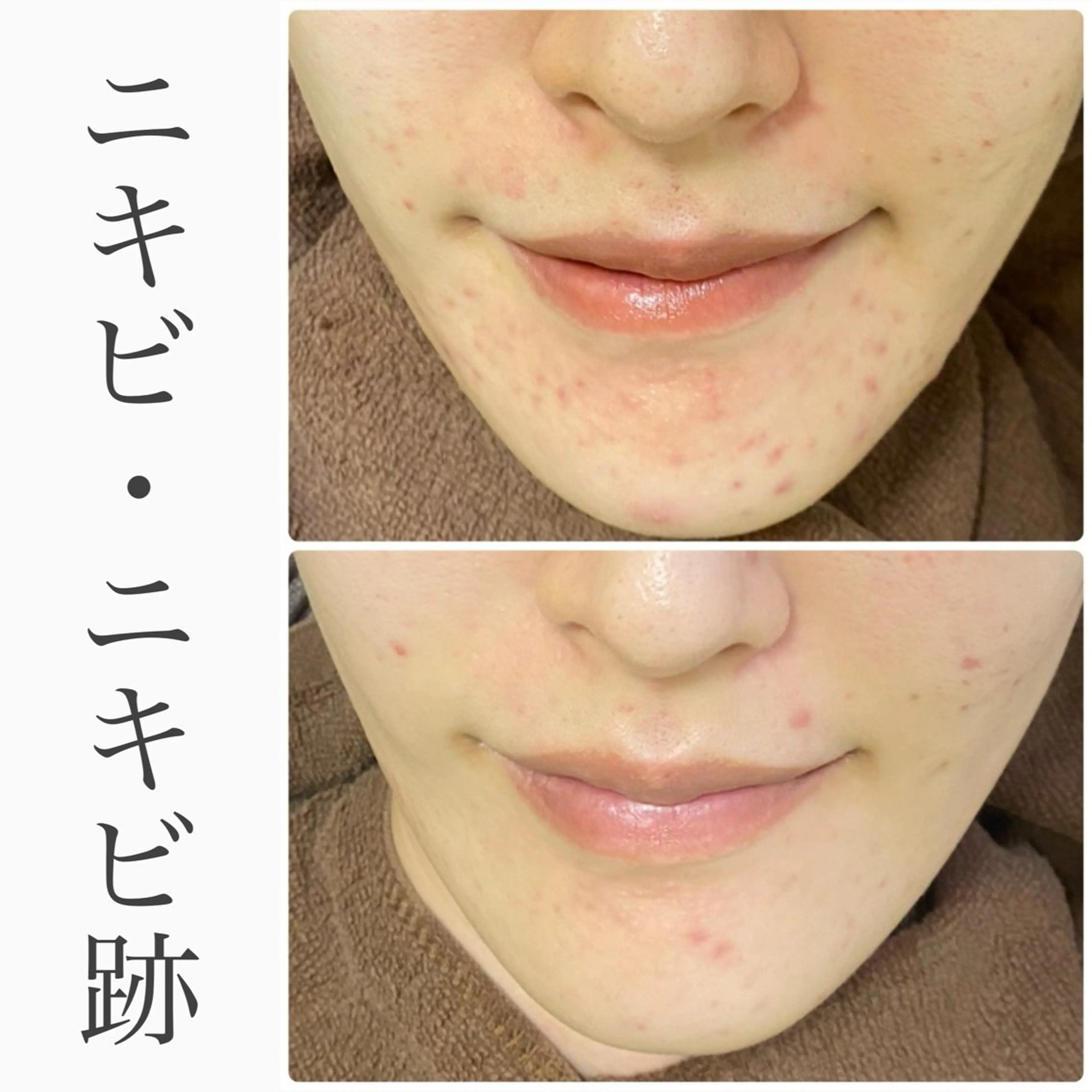 ハーブピーリング専門 BIOEL横浜のエステ・リラクイメージ